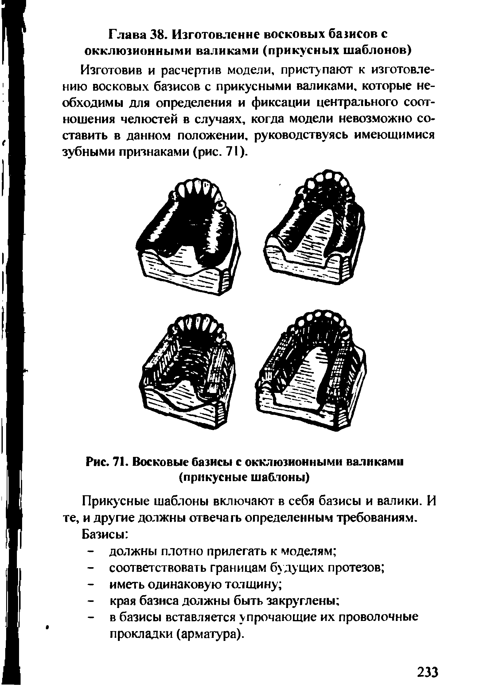 Рис. 71. Восковые базисы с окклюзионными валиками (прикусные шаблоны)...