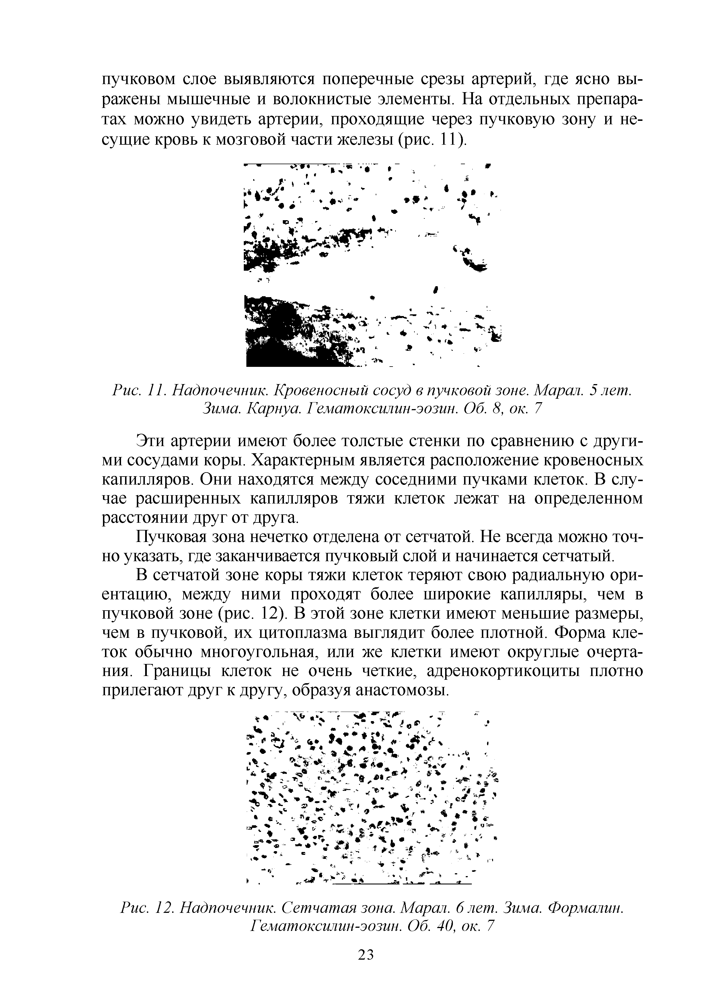 Рис. 12. Надпочечник. Сетчатая зона. Марал. 6 лет. Зима. Формалин. Гематоксилин-эозин. Об. 40, ок. 7...