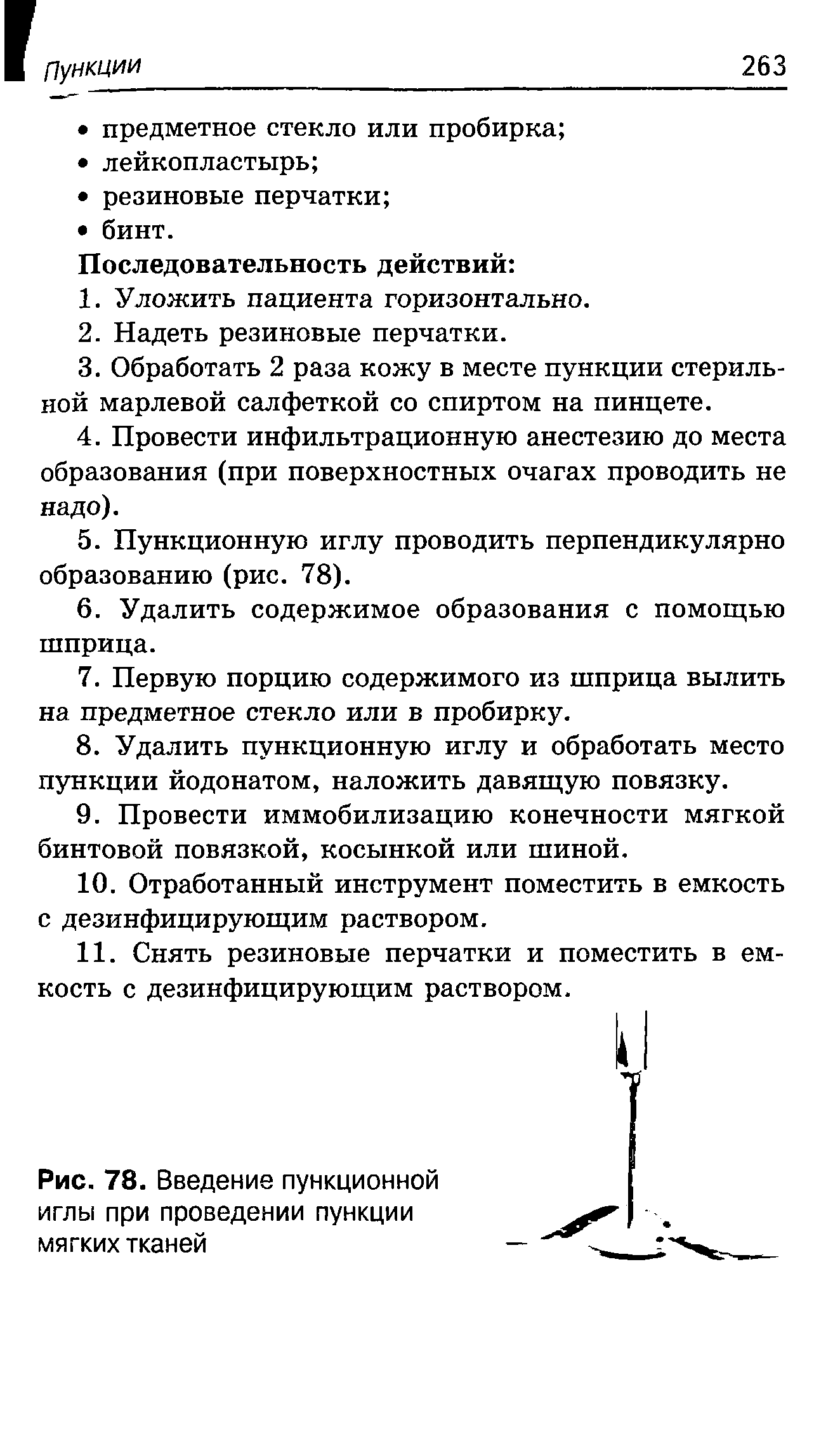 Рис. 78. Введение пункционной иглы при проведении пункции мягких тканей...