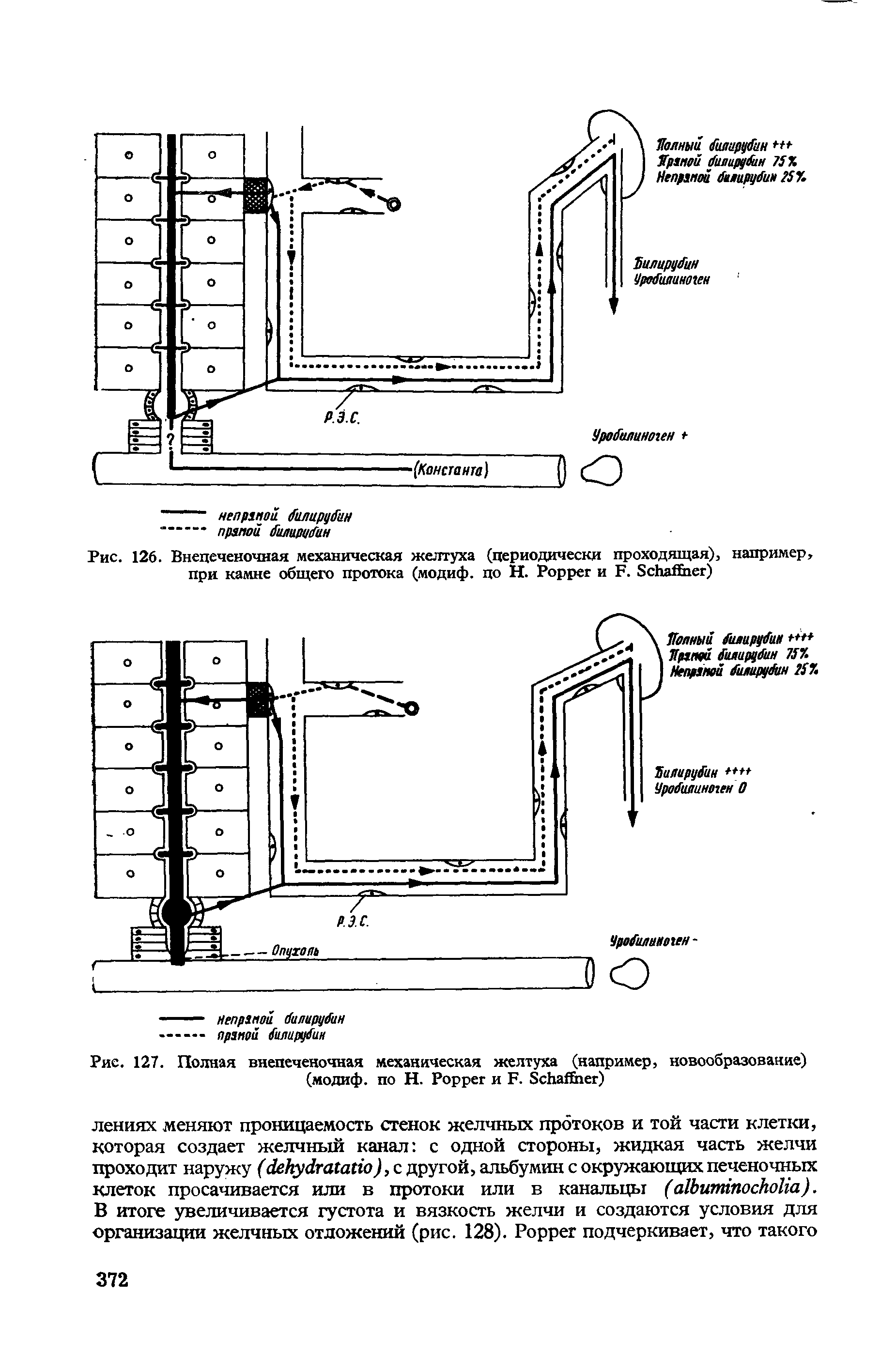 Рис. 126. Внепеченочная механическая желтуха (периодически проходящая), например, при камне общего протока (модиф. по Н. P и F. S )...