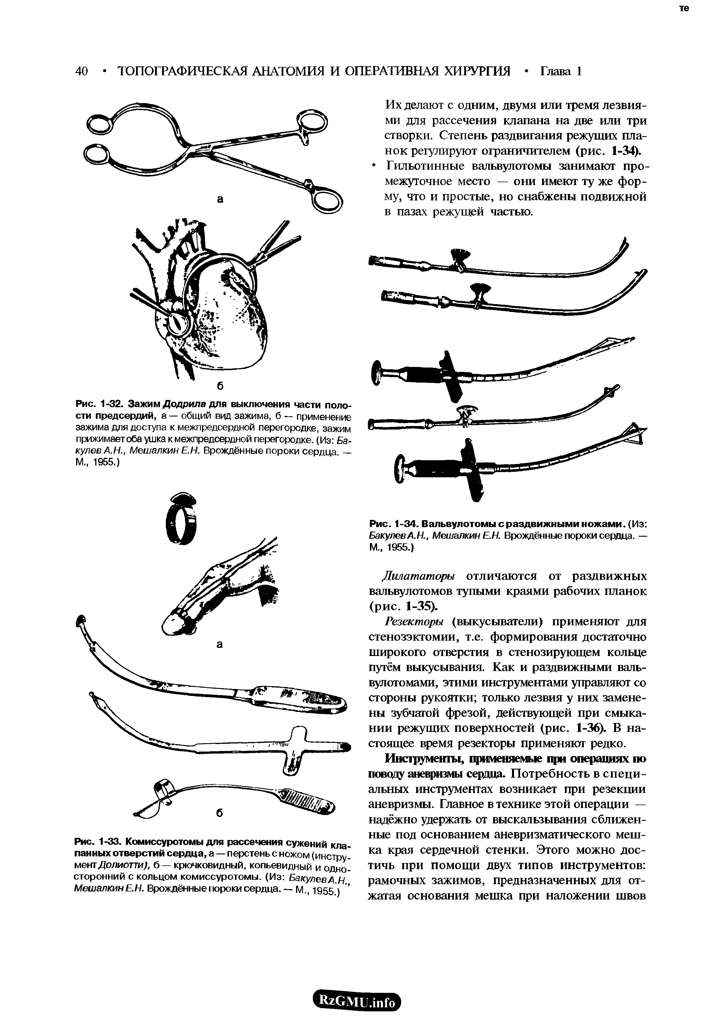 Рис. 1-32. Зажим Додрила для выключения части полости предсердий, а — общий вид зажима, б — применение зажима для доступа к межпредсердной перегородке, зажим прижимает оба ушка к межпредсердной перегородке. (Из Бакулев А.Н., Мешалкин Е.Н. Врождённые пороки сердца — М 1955.)...