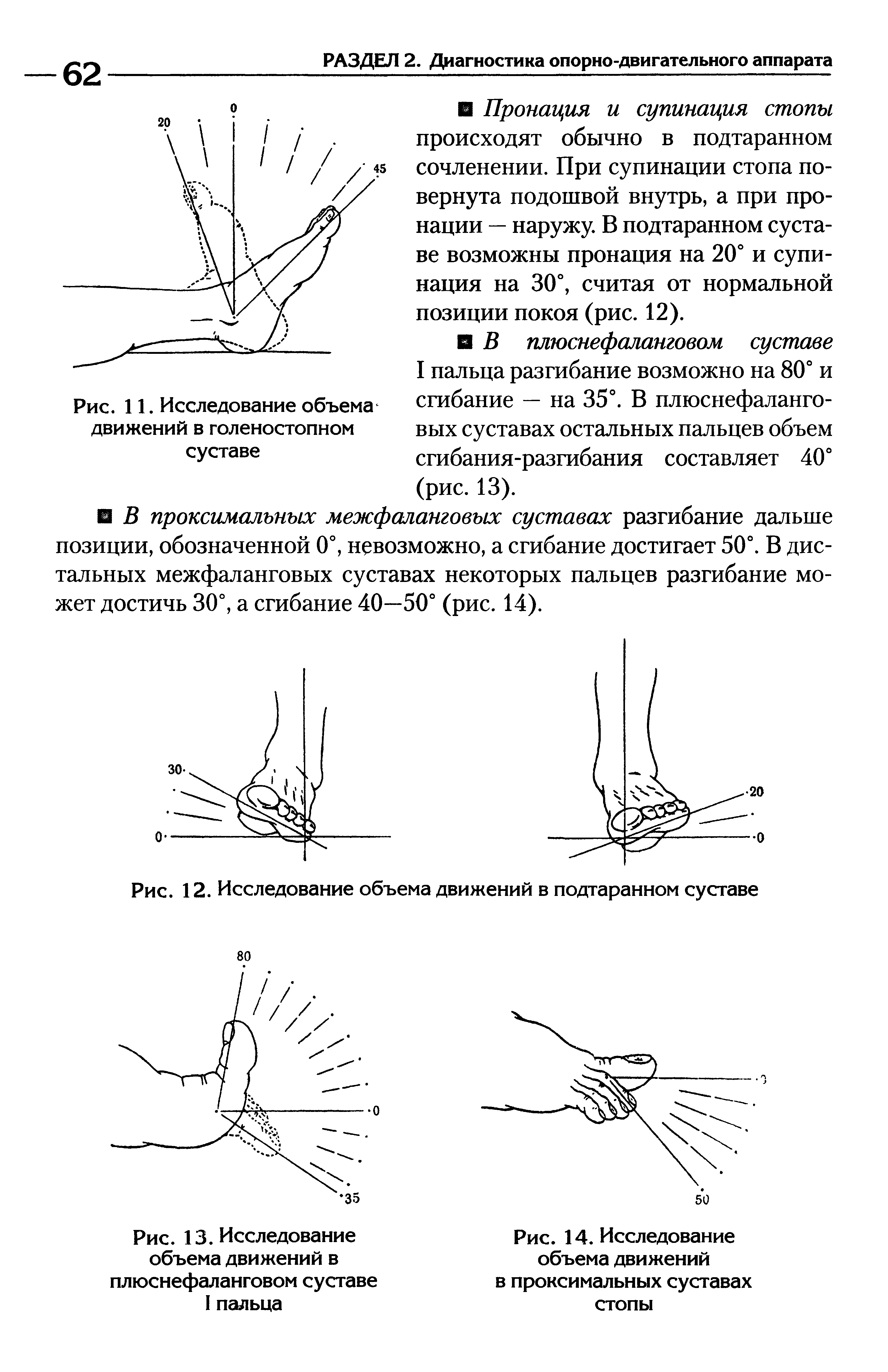 Рис. 13. Исследование объема движений в плюснефаланговом суставе I пальца...