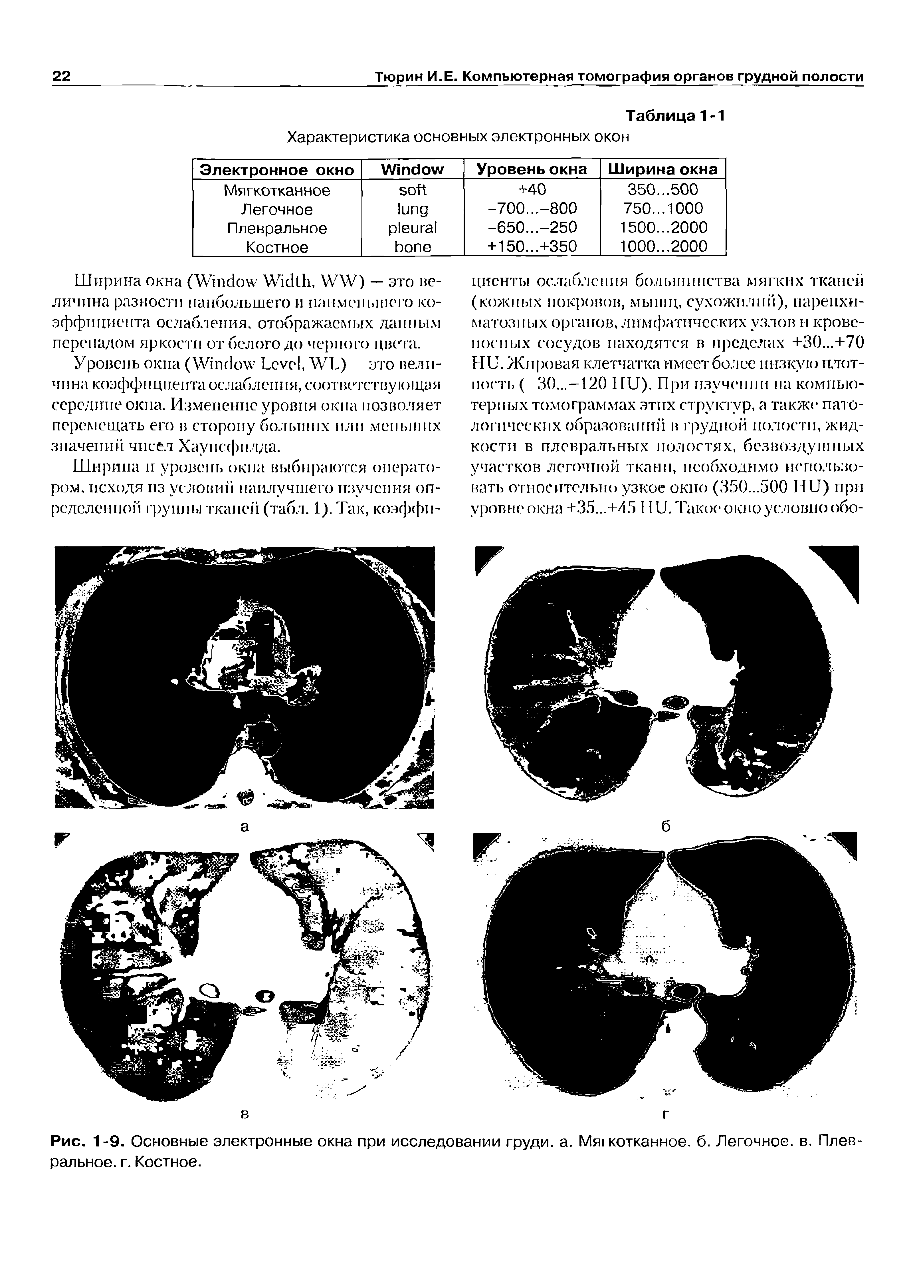 Рис. 1-9. Основные электронные окна при исследовании груди, а. Мягкотканное, б. Легочное, в. Плевральное. г. Костное.