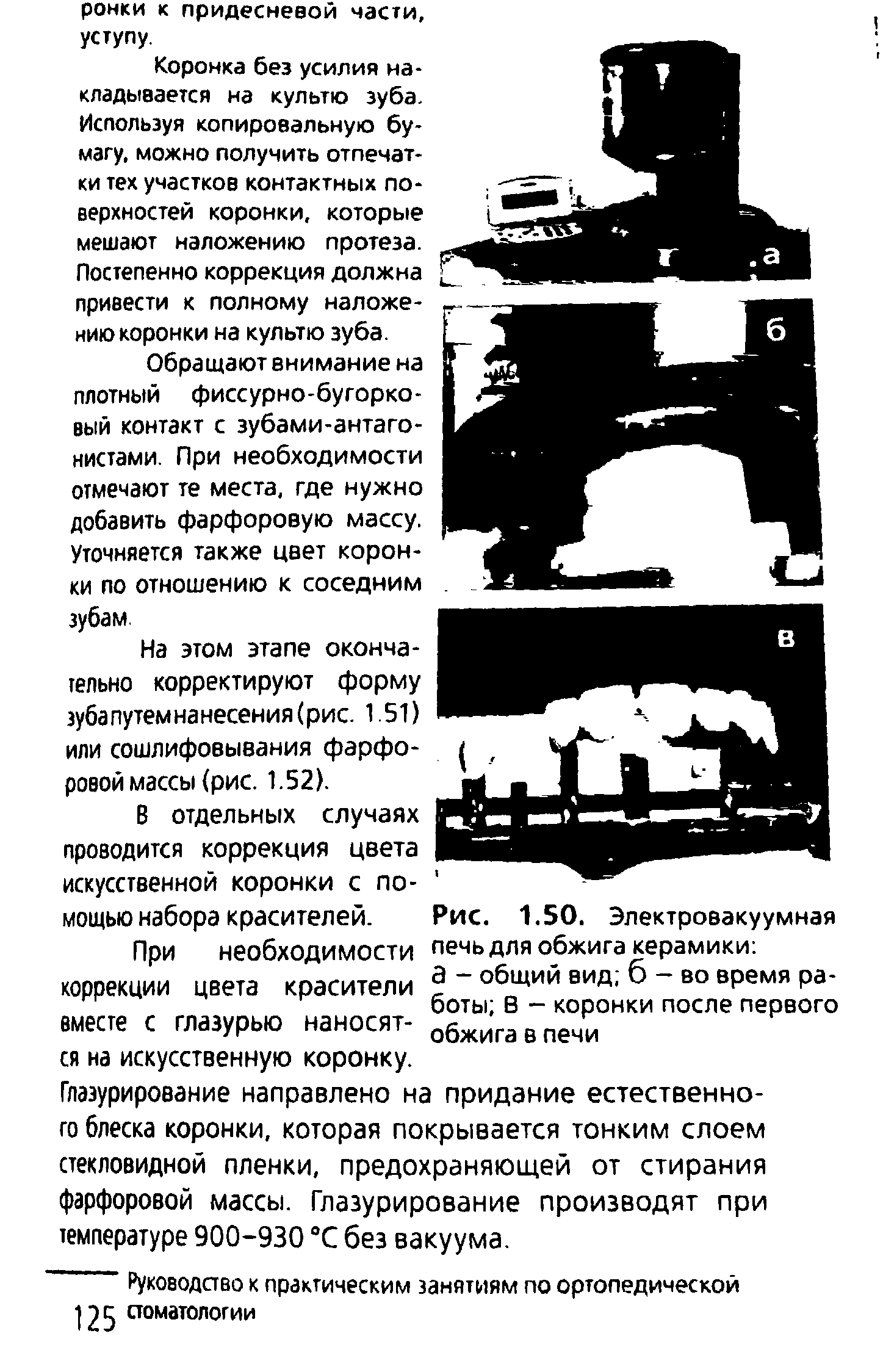 Рис. 1.50. Электровакуумная печь для обжига керамики а - общий вид б - во время работы В - коронки после первого обжига в печи...