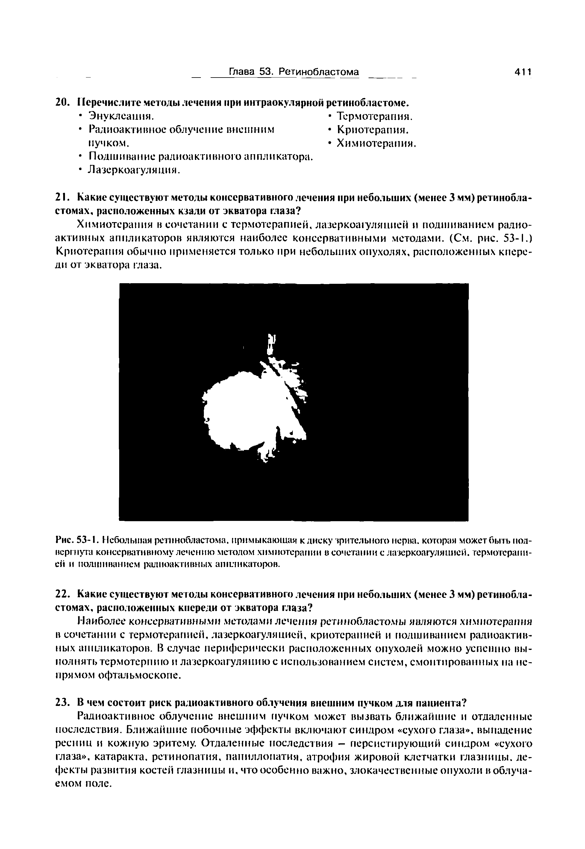 Рис. 53-1. Небольшая ретинобластома, примыкающая к диску зрительного нерва, которая может быть подвергнута консервативному лечению метолом химиотерапии в сочетании с лазеркоагуляцией. термотерапией и подшиванием радиоактивных ап 1иш кагоров.
