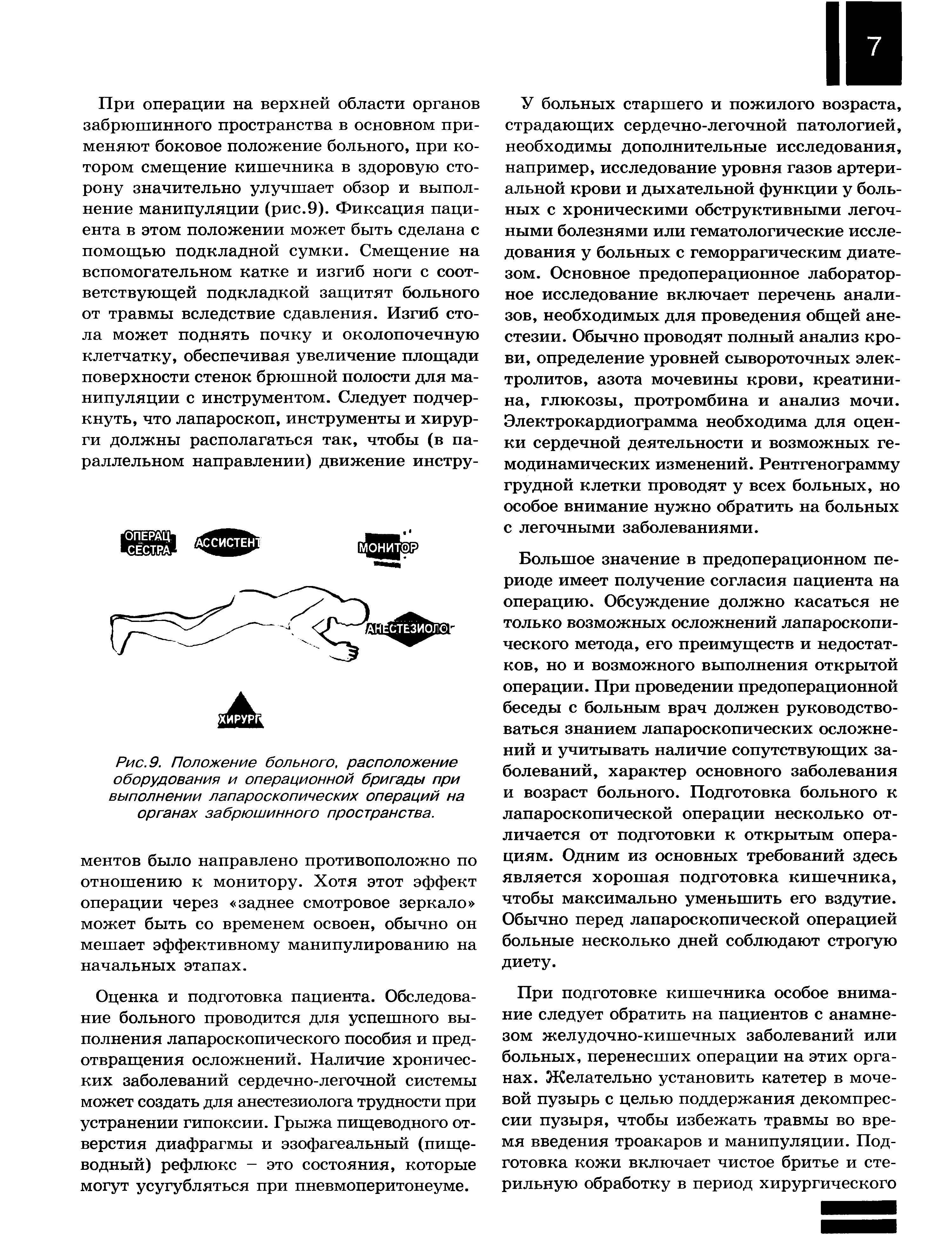 Рис. 9. Положение больного, расположение оборудования и операционной бригады при выполнении лапароскопических операций на органах забрюшинного пространства.