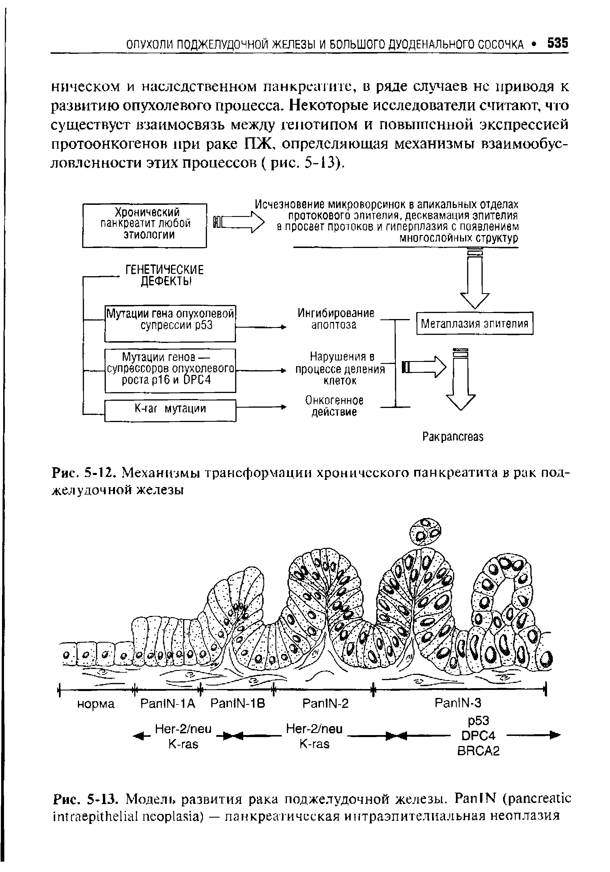 Рис. 5-13. Модель развития рака поджелудочной железы. P IN ( ) — панкреатическая интраэпителиальная неоплазия...