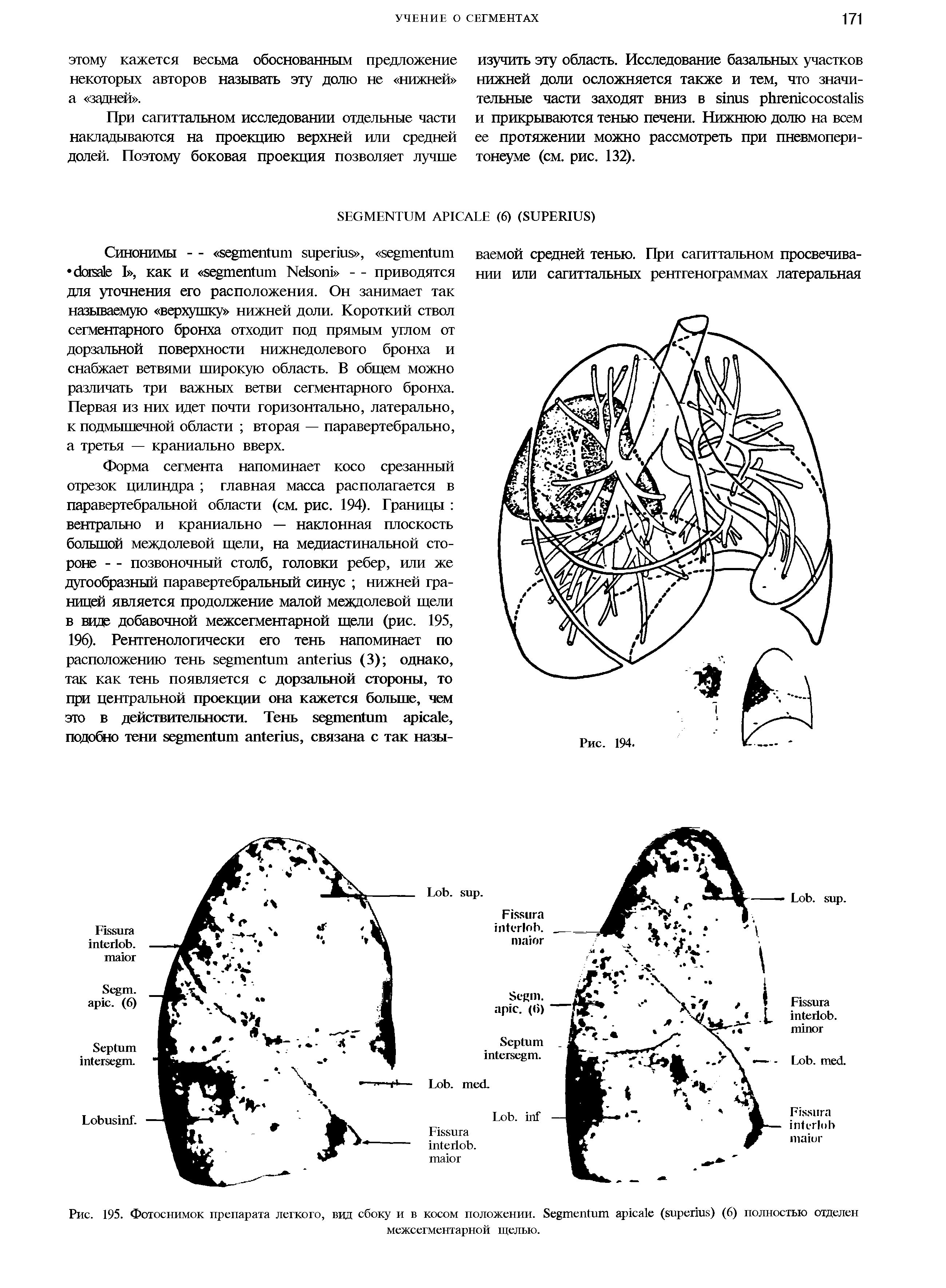 Рис. 195. Фотоснимок препарата легкого, вид сбоку и в косом положении. S ( ) (6) полностью отделен межсегментарной щелью.