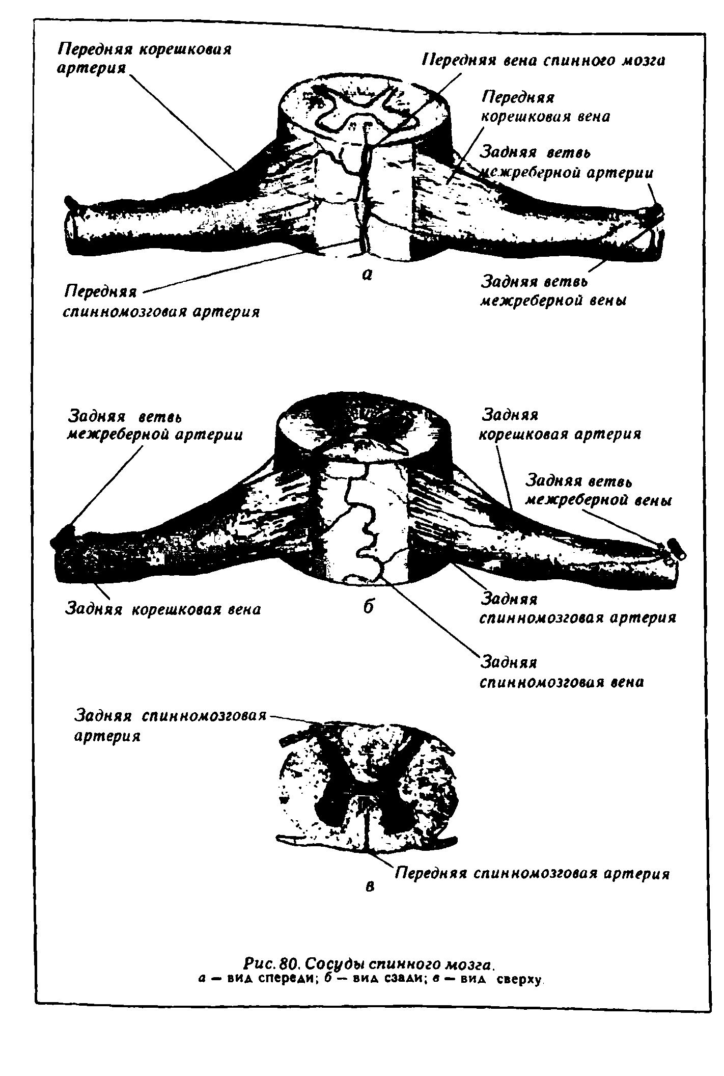 Рис. 80. Сосуды спинного мозга, а — вид спереди б — вид сзади в — вид сверху...
