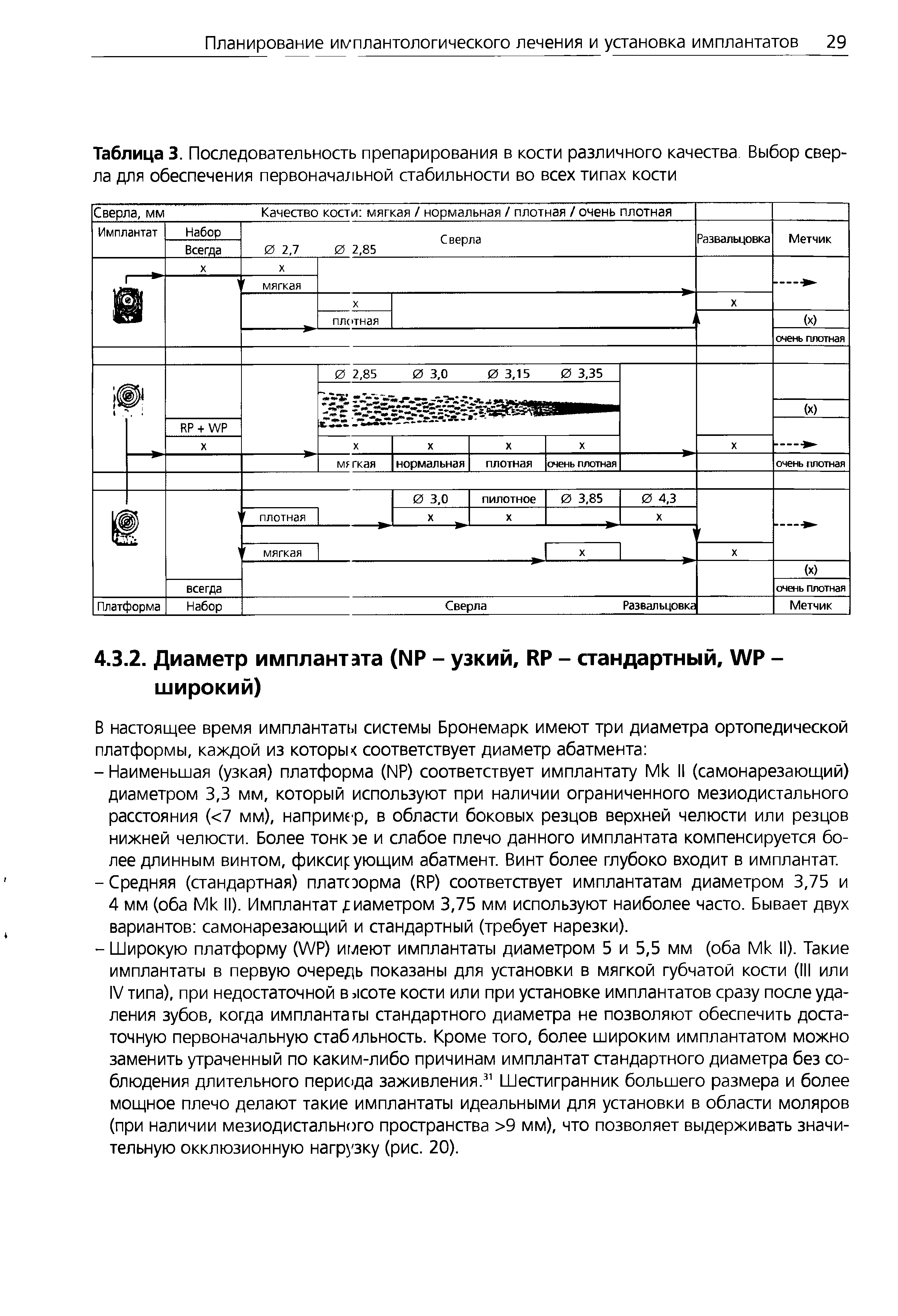 Таблица 3. Последовательность препарирования в кости различного качества Выбор сверла для обеспечения первоначальной стабильности во всех типах кости...