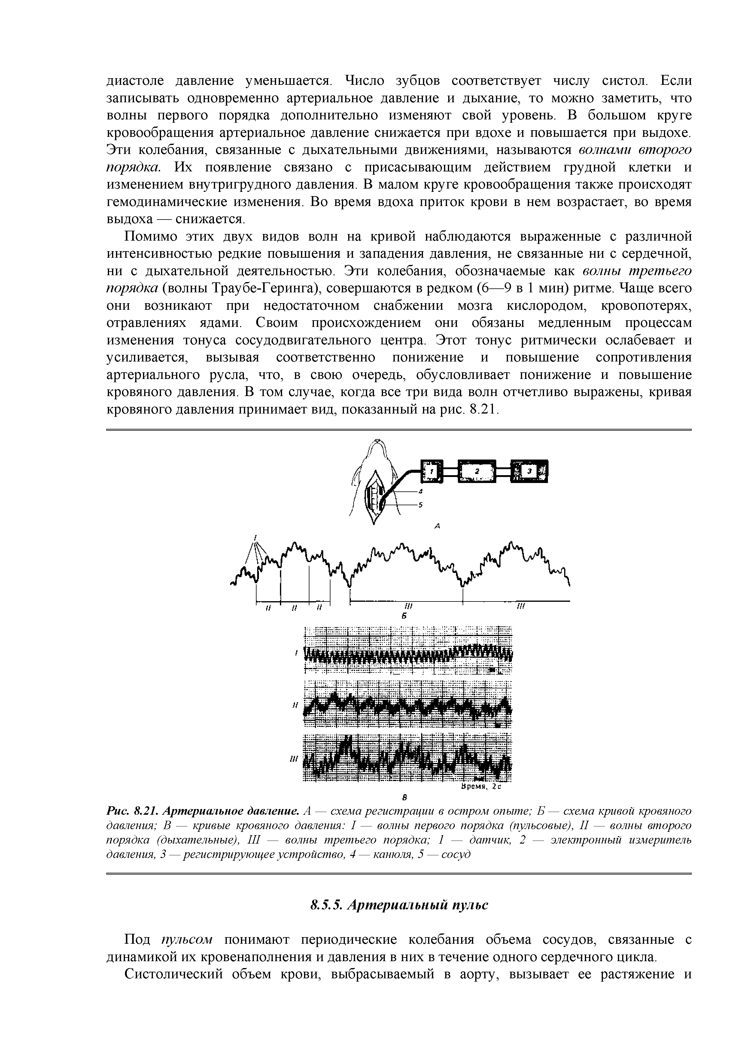 Рис. 8.21. Артериальное давление. А — схема регистрации в остром опыте Б— схема кривой кровяного давления В — кривые кровяного давления I — волны первого порядка (пульсовые), II — волны второго порядка (дыхательные), III — волны третьего порядка 1 — датчик, 2 — электронный измеритель давления, 3 — регистрирующее устройство, 4 — канюля, 5 — сосуд...