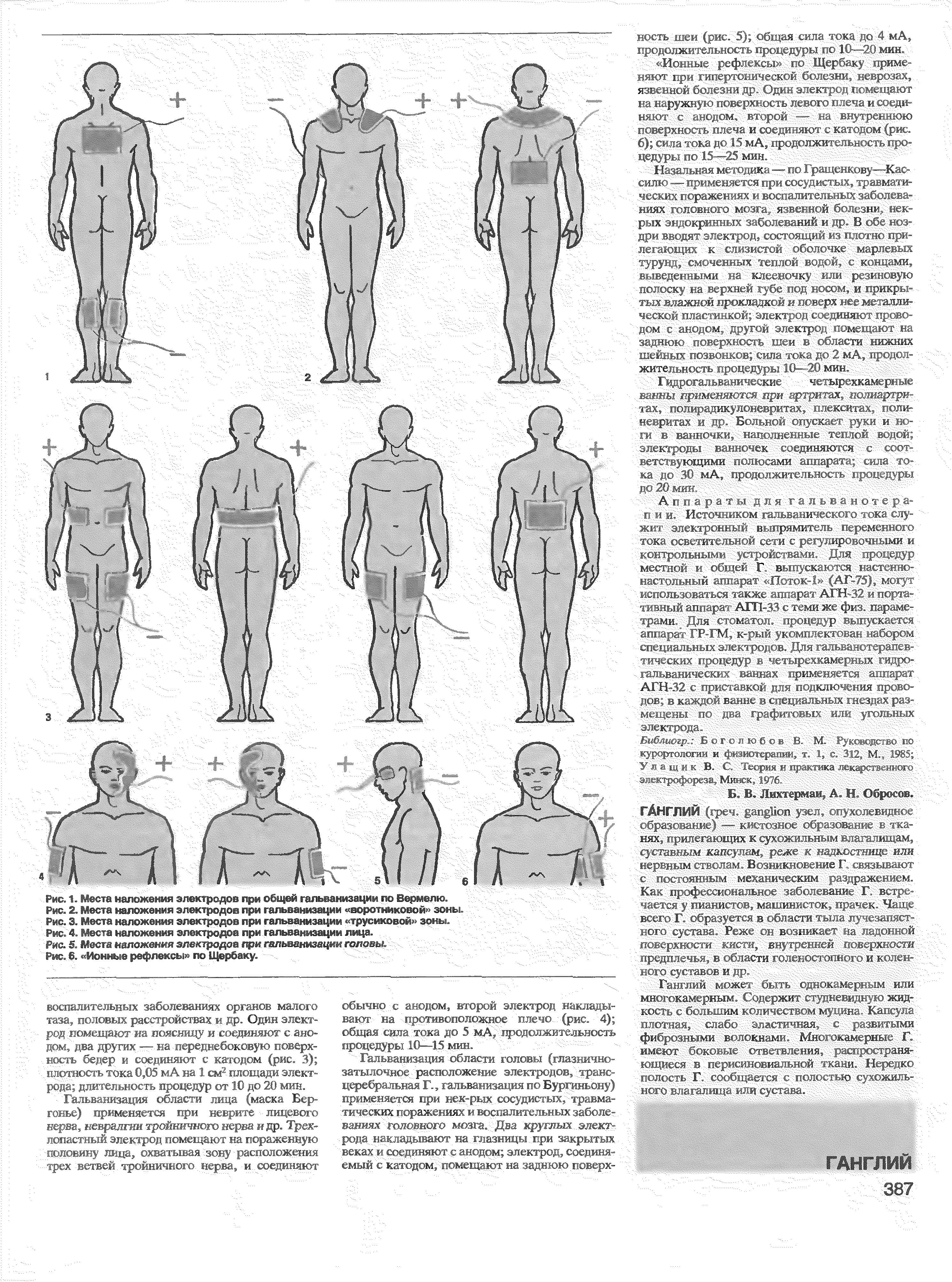 Рис. 3. Места наложения электродов при гальванизации трусиковой зоны.