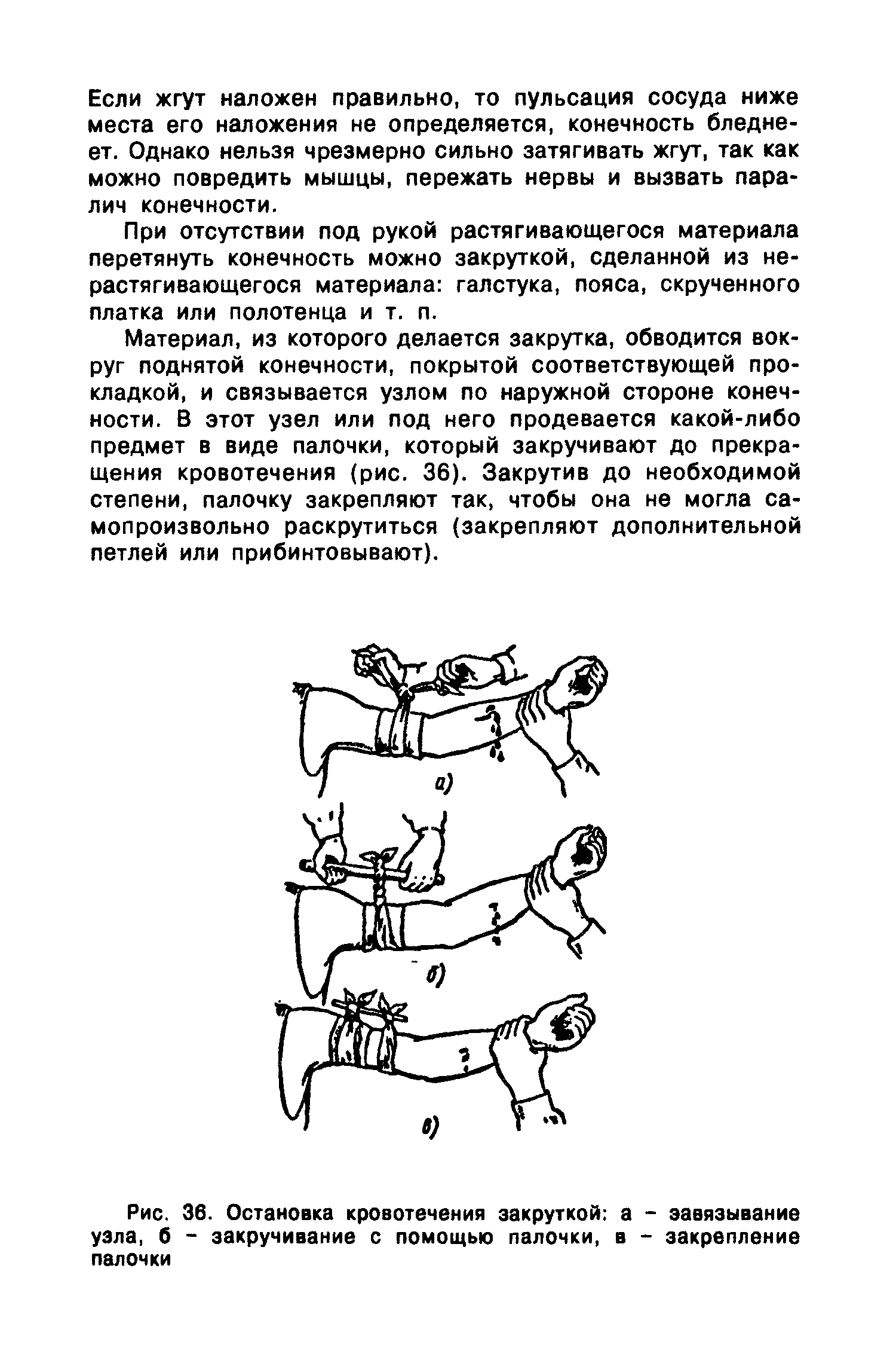 Рис. 36. Остановка кровотечения закруткой а - завязывание узла, б - закручивание с помощью палочки, в - закрепление палочки...