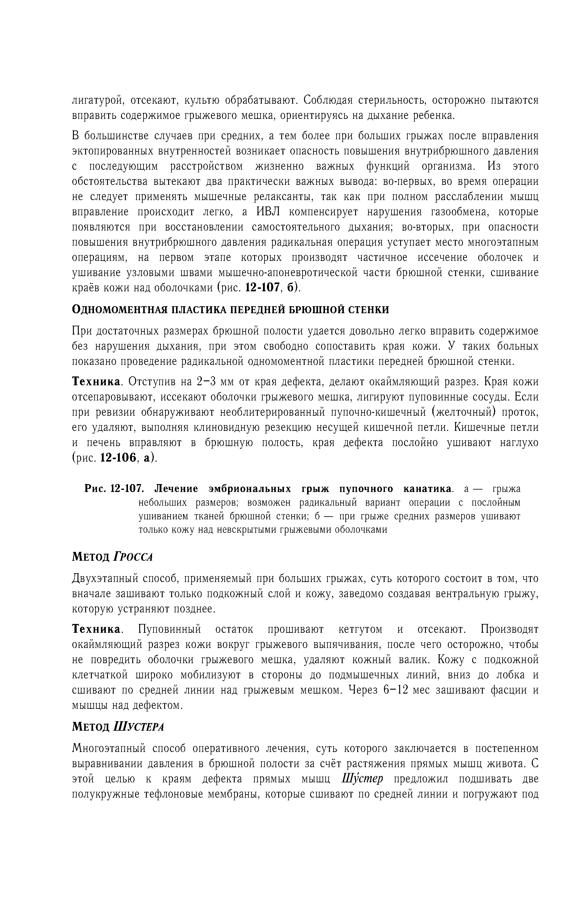 Рис. 12-107. Лечение эмбриональных грыж пупочного канатика, а — грыжа небольших размеров возможен радикальный вариант операции с послойным ушиванием тканей брюшной стенки б — при грыже средних размеров ушивают только кожу над невскрытыми грыжевыми оболочками...