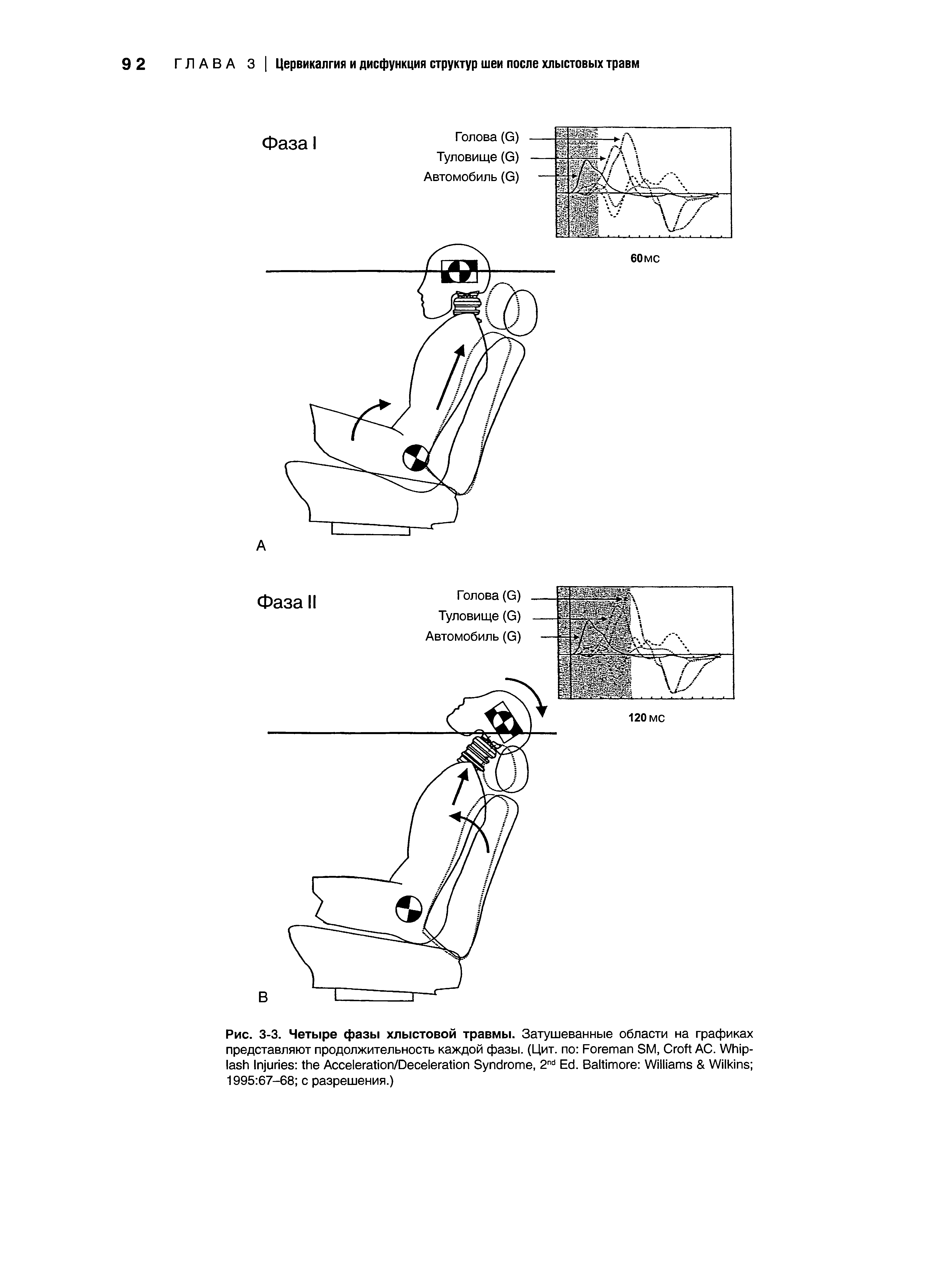Рис. 3-3. Четыре фазы хлыстовой травмы. Затушеванные области на графиках представляют продолжительность каждой фазы. (Цит. по F SM, C AC. W I A /D S , 2 E . B W W 1995 67-68 с разрешения.)...