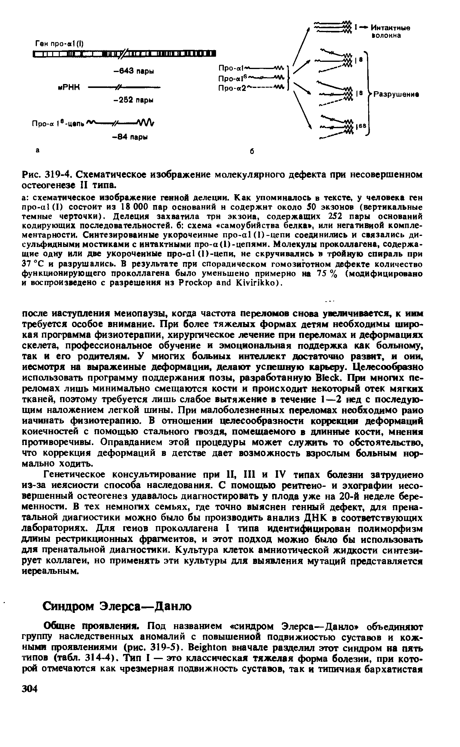 Рис. 319-4. Схематическое изображение молекулярного дефекта при несовершенном остеогенезе II типа.