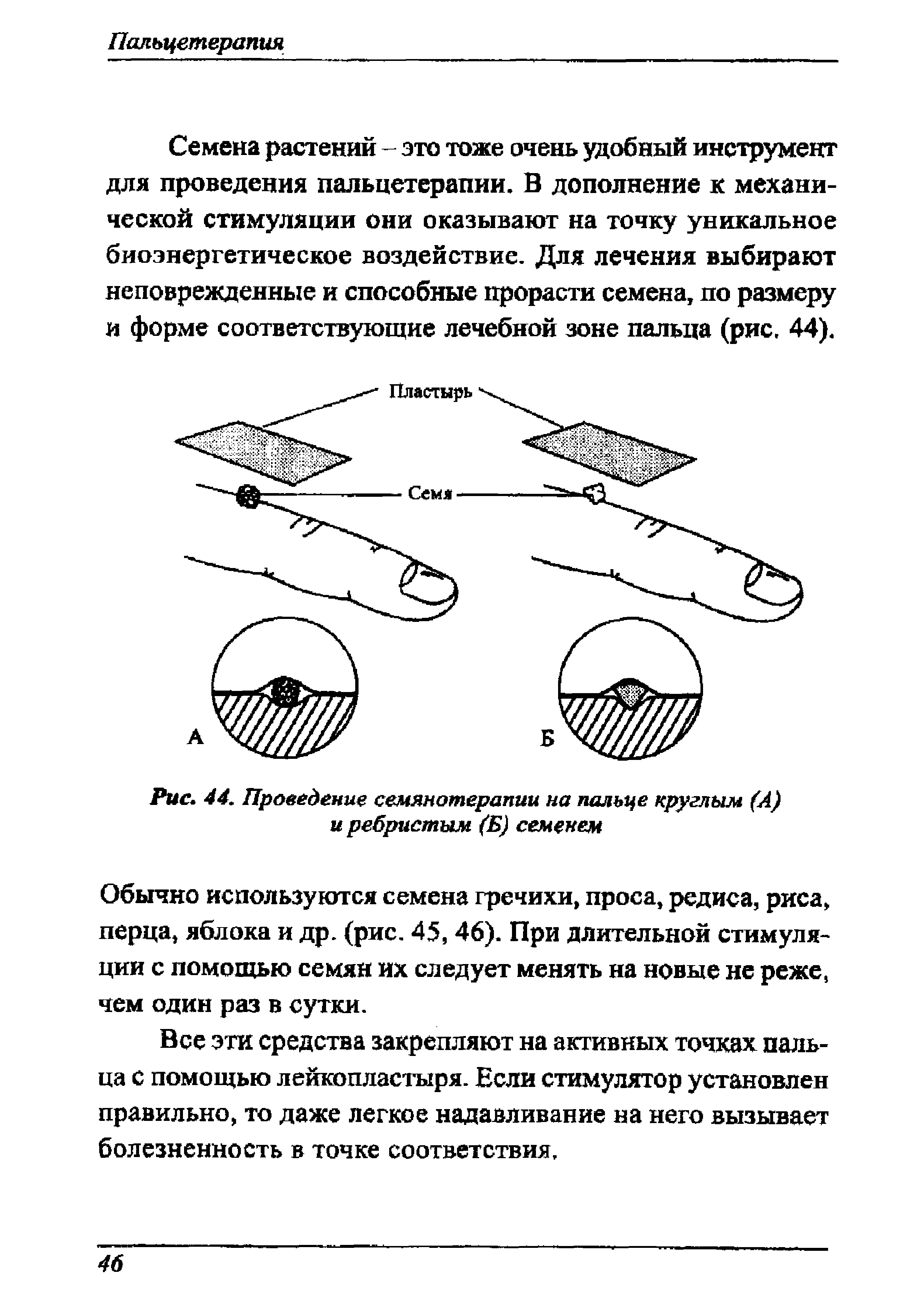 Рис. 44. Проведение семянотерапии на пальце круглым (А) и ребристым (Б) семенем...