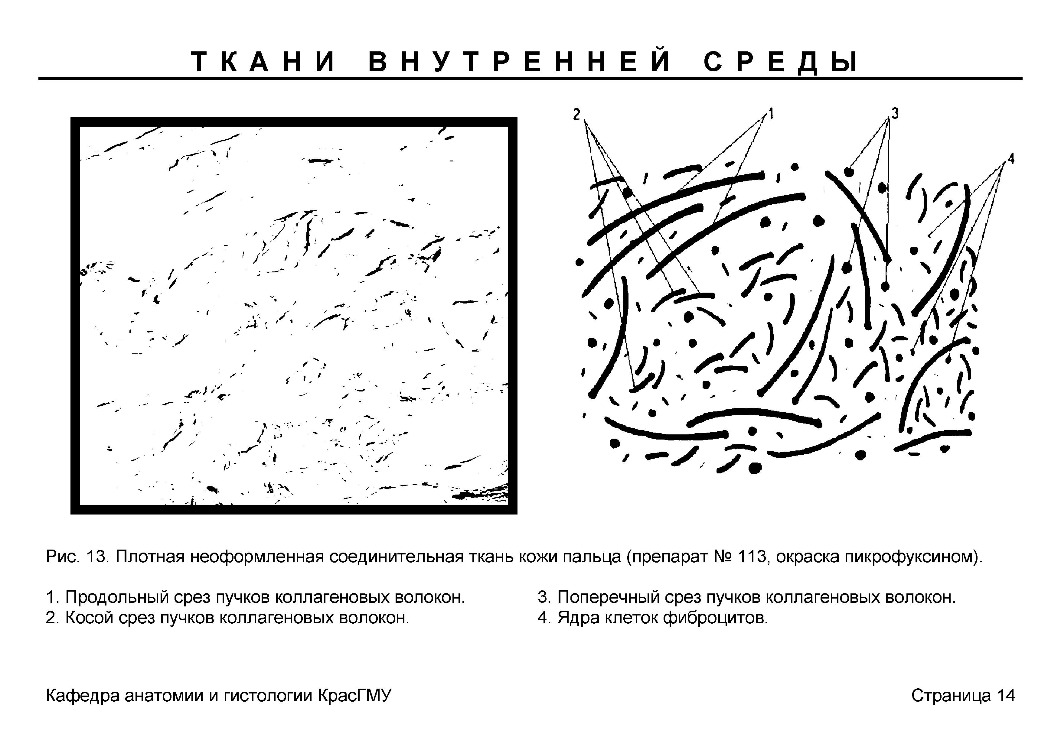 Рис. 13. Плотная неоформленная соединительная ткань кожи пальца (препарат № 113, окраска пикрофуксином).