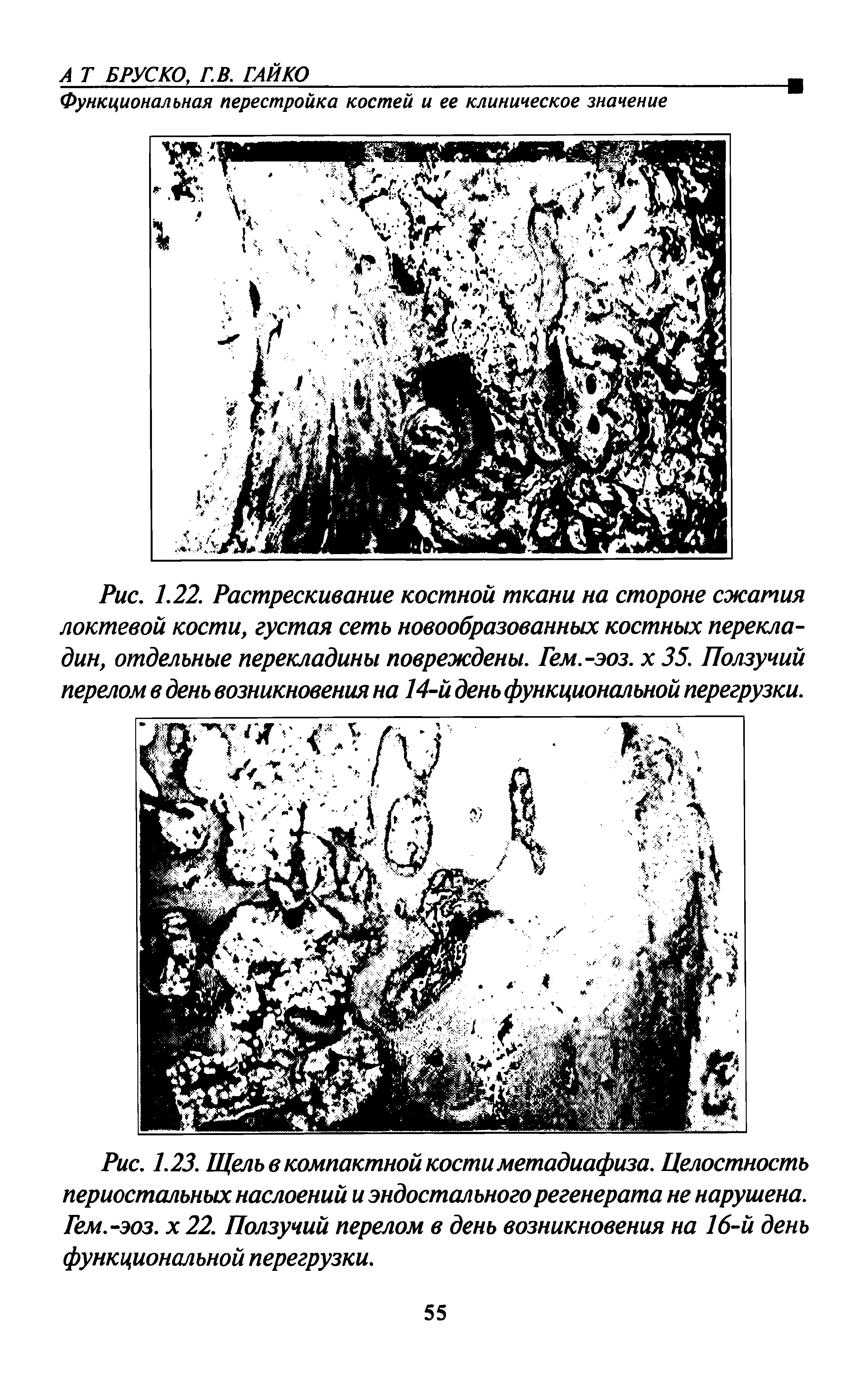 Рис. 1.22. Растрескивание костной ткани на стороне сжатия локтевой кости, густая сеть новообразованных костных перекладин, отдельные перекладины повреждены. Гем.-эоз. х 35. Ползучий перелом в день возникновения на 14-й день функциональной перегрузки.