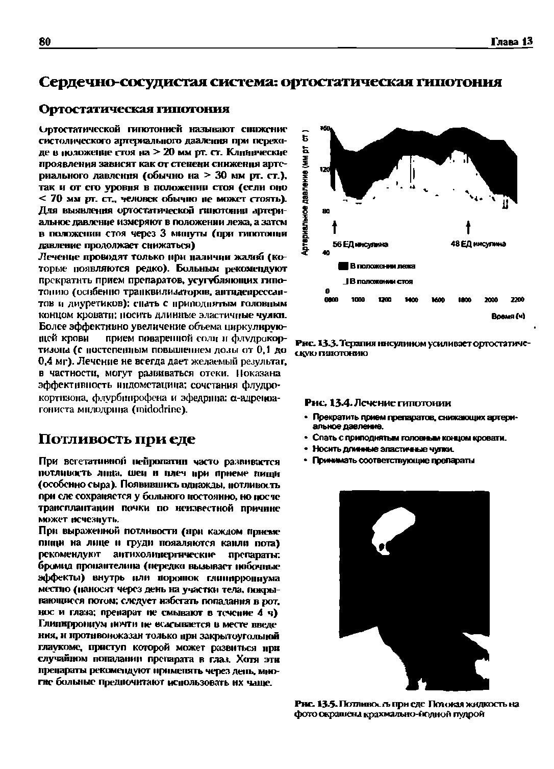 Рис. 13-5-Потливо, - , при еде Птокая жидкость на фото ежрашена крахмально-иодной пудрой...