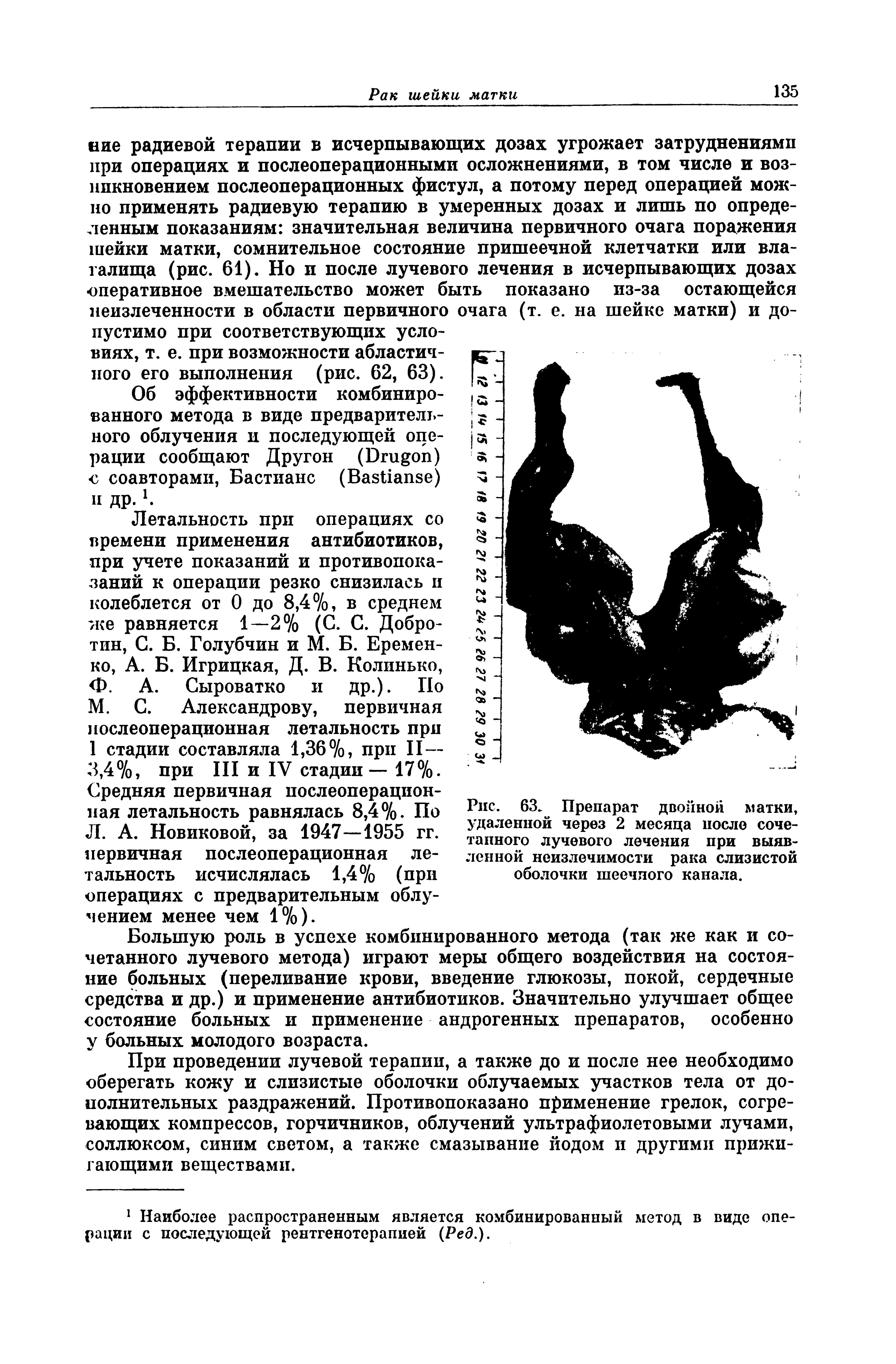 Рис. 63. Препарат двойной матки, удаленной через 2 месяца после сочетанного лучевого лечения при выявленной неизлечимости рака слизистой оболочки шеечного канала.