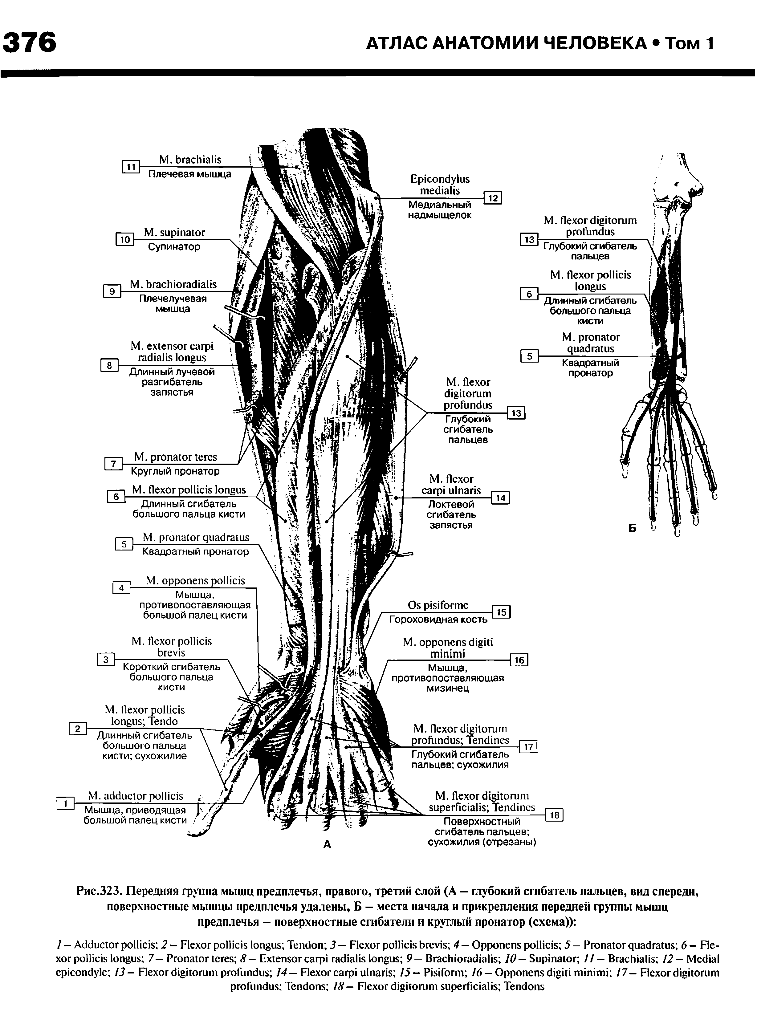 Рис.323. Передняя группа мышц предплечья, правого, третий слой (А — глубокий сгибатель пальцев, вид спереди, поверхностные мышцы предплечья удалены, Б — места начала и прикрепления передней группы мышц предплечья - поверхностные сгибатели и круглый пронатор (схема)) ...