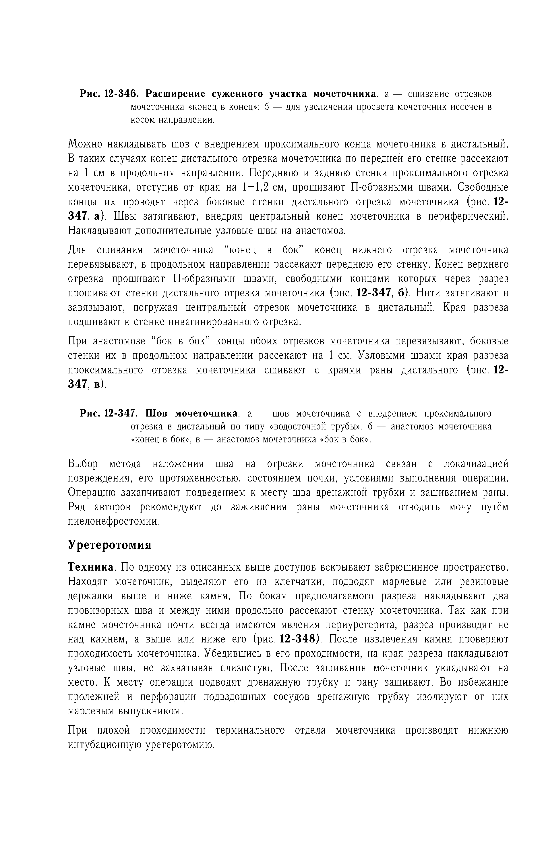 Рис. 12-347. Шов мочеточника, а — шов мочеточника с внедрением проксимального отрезка в дистальный по типу водосточной трубы б — анастомоз мочеточника конец в бок в — анастомоз мочеточника бок в бок .