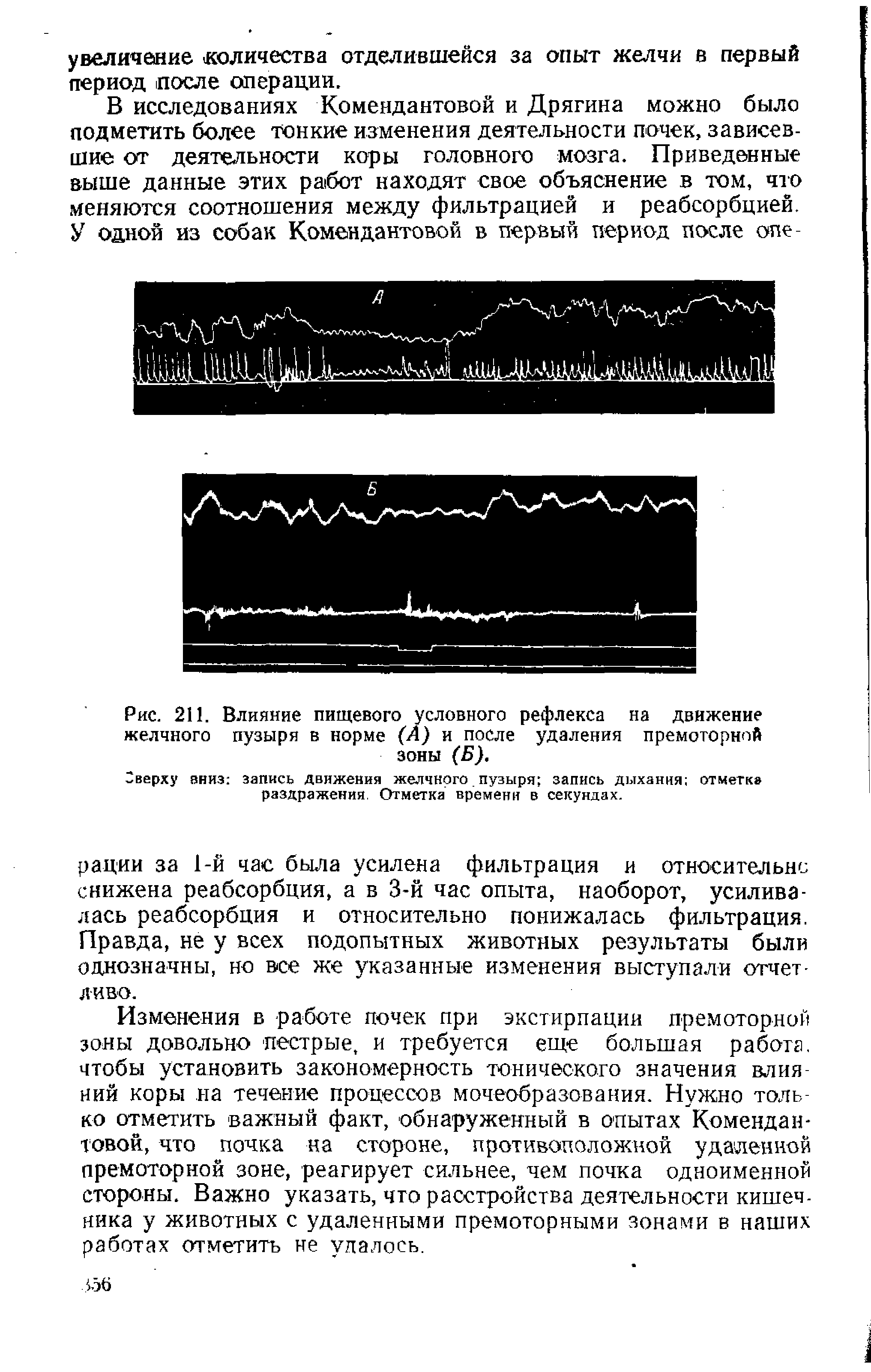 Рис. 211. Влияние пищевого условного рефлекса на движение желчного пузыря в норме (А) и после удаления премоторной зоны (Б).
