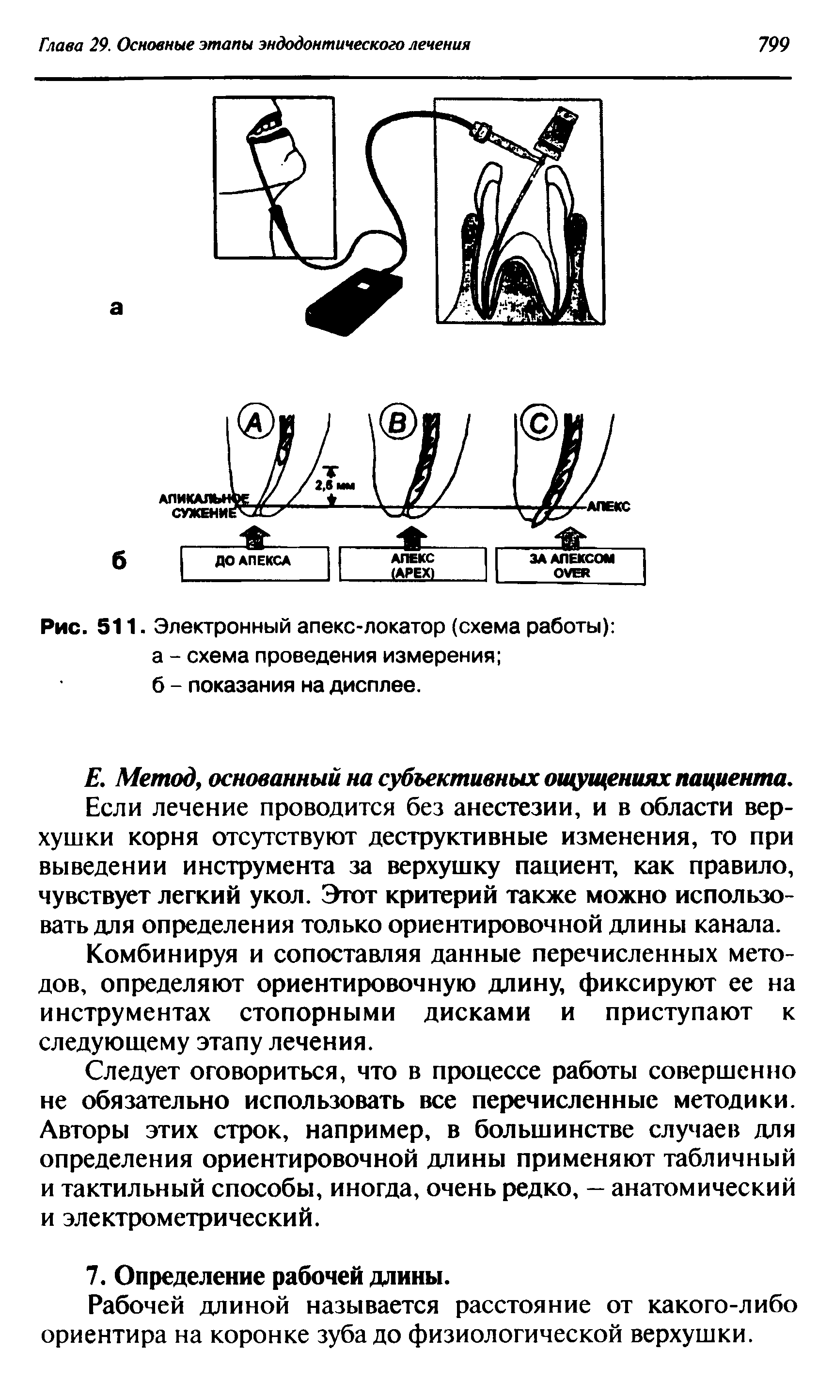 Рис. 511. Электронный апекс-локатор (схема работы) а - схема проведения измерения ...