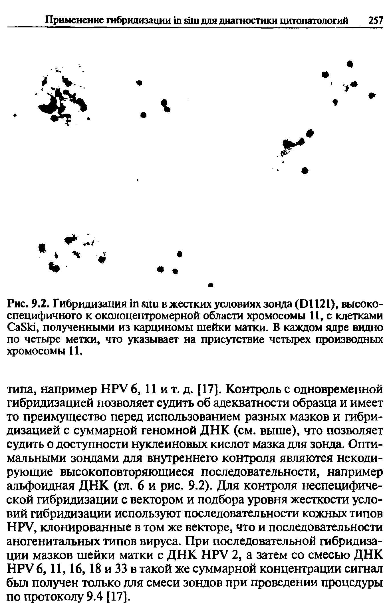 Рис. 9.2. Гибридизация в жестких условиях зонда (D1121), высокоспецифичного к околоцентромерной области хромосомы 11, с клетками C S , полученными из карциномы шейки матки. В каждом ядре видно по четыре метки, что указывает на присутствие четырех производных хромосомы 11.