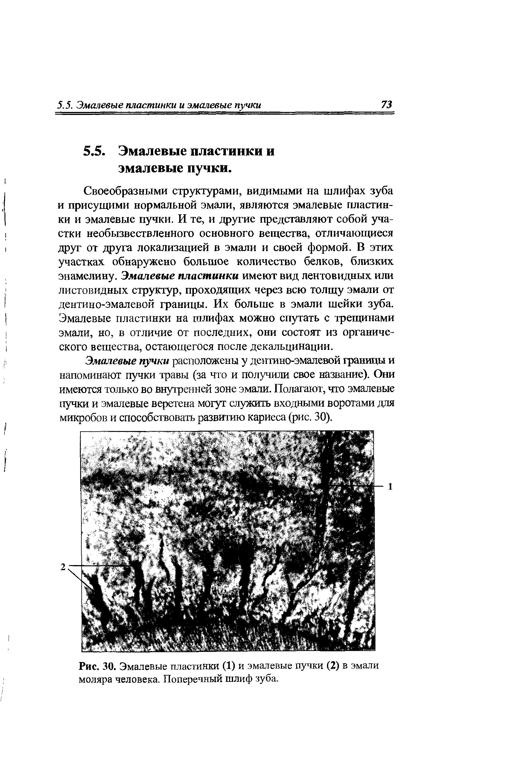 Рис. 30. Эмалевые пластинки (1) и эмалевые пучки (2) в эмали моляра человека. Поперечный шлиф зуба.