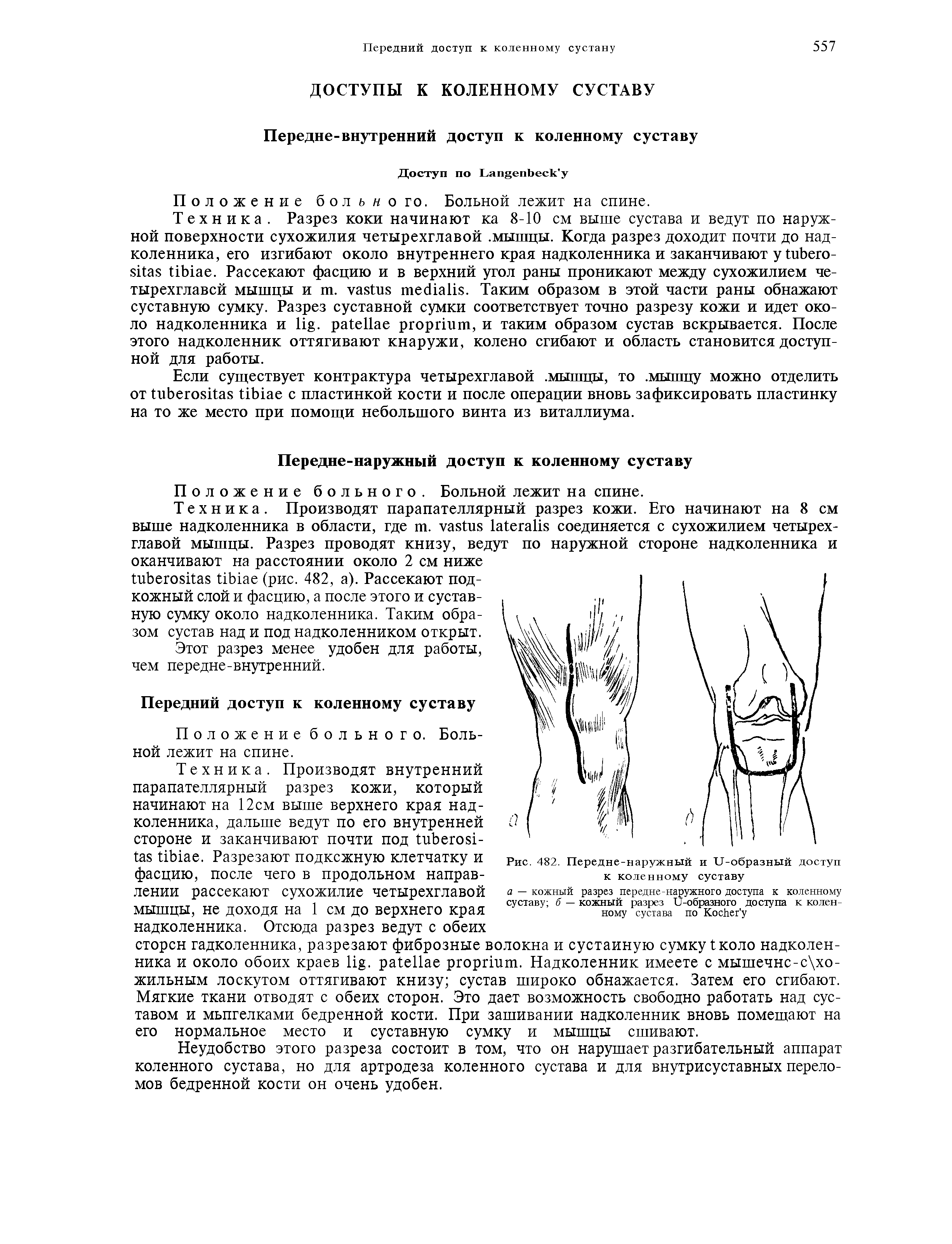 Рис. 482. Передне-наружный и "СТ-образный доступ к коленному суставу...