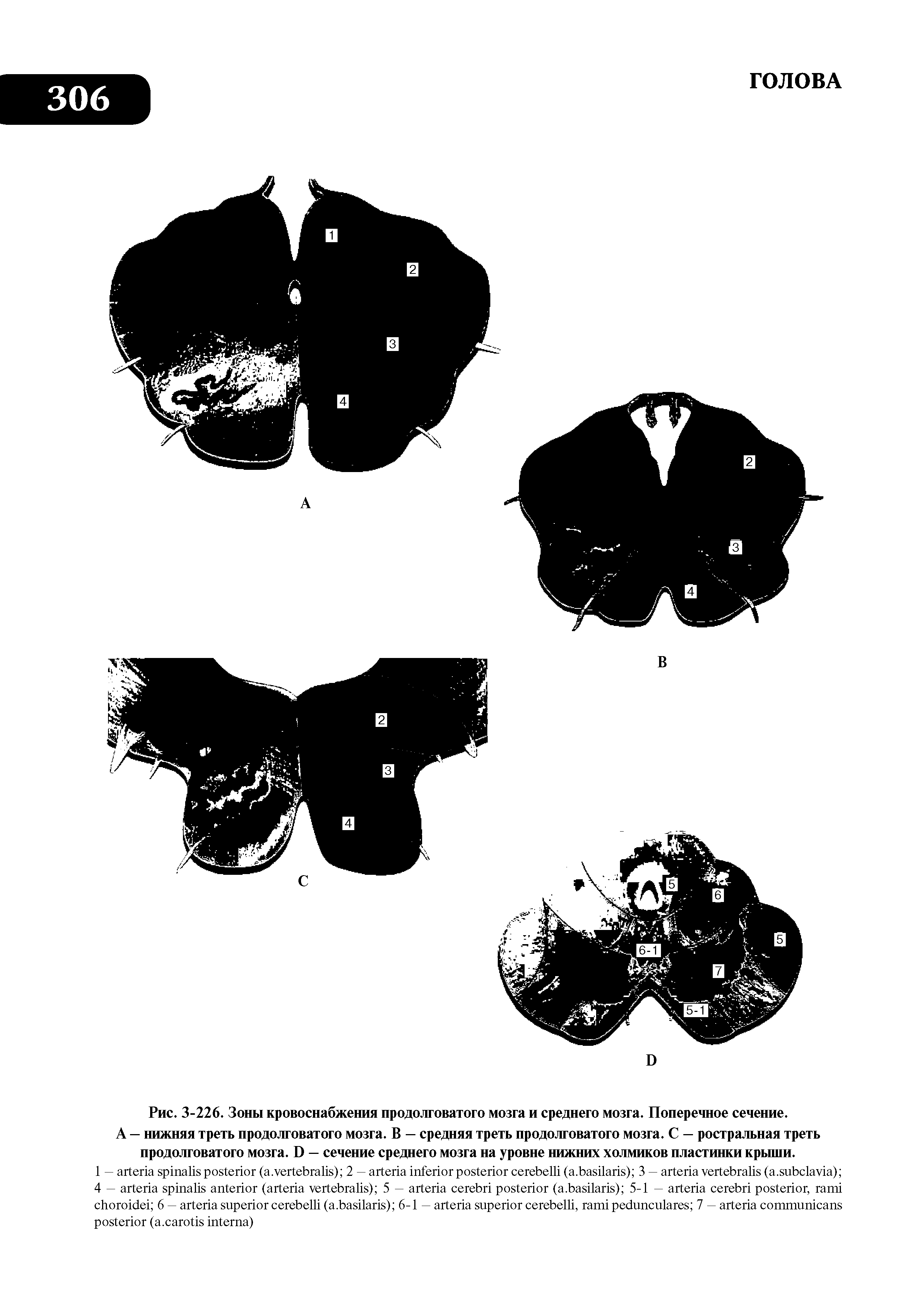 Рис. 3-226. Зоны кровоснабжения продолговатого мозга и среднего мозга. Поперечное сечение.