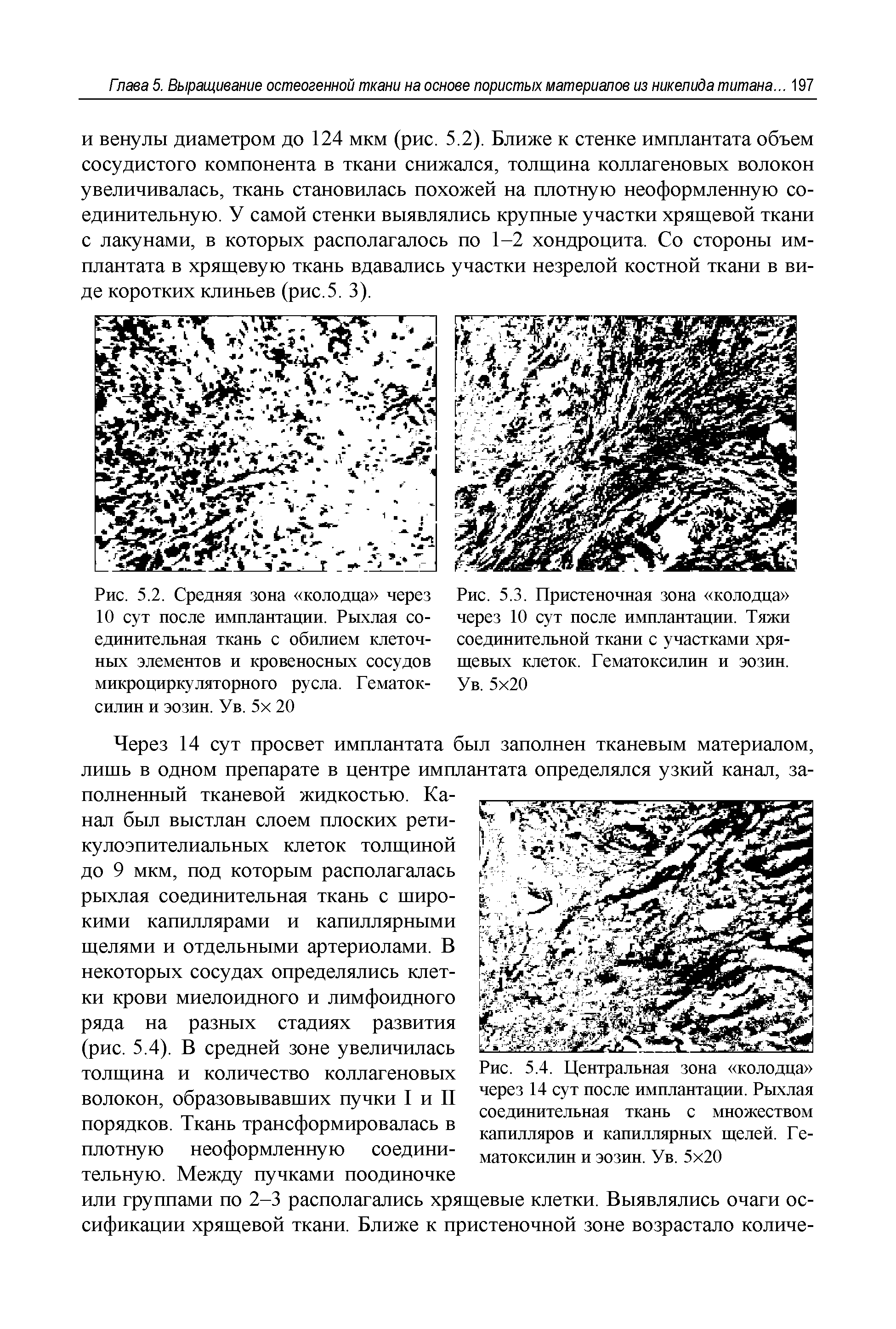 Рис. 5.2. Средняя зона колодца через 10 сут после имплантации. Рыхлая соединительная ткань с обилием клеточных элементов и кровеносных сосудов микроциркуляторного русла. Гематок-силин и эозин. Ув. 5х 20...