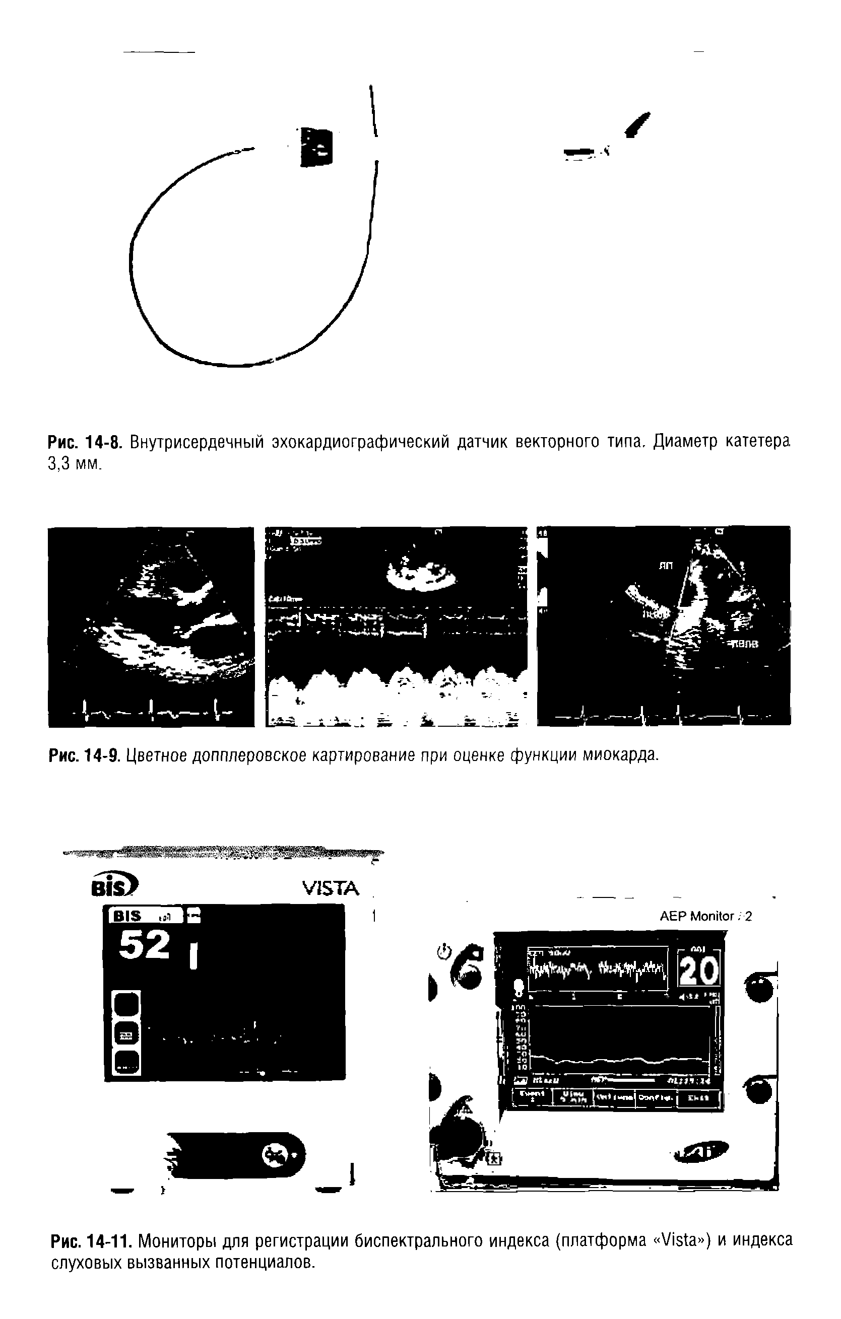 Рис. 14-11. Мониторы для регистрации биспектрального индекса (платформа V ) и индекса слуховых вызванных потенциалов.