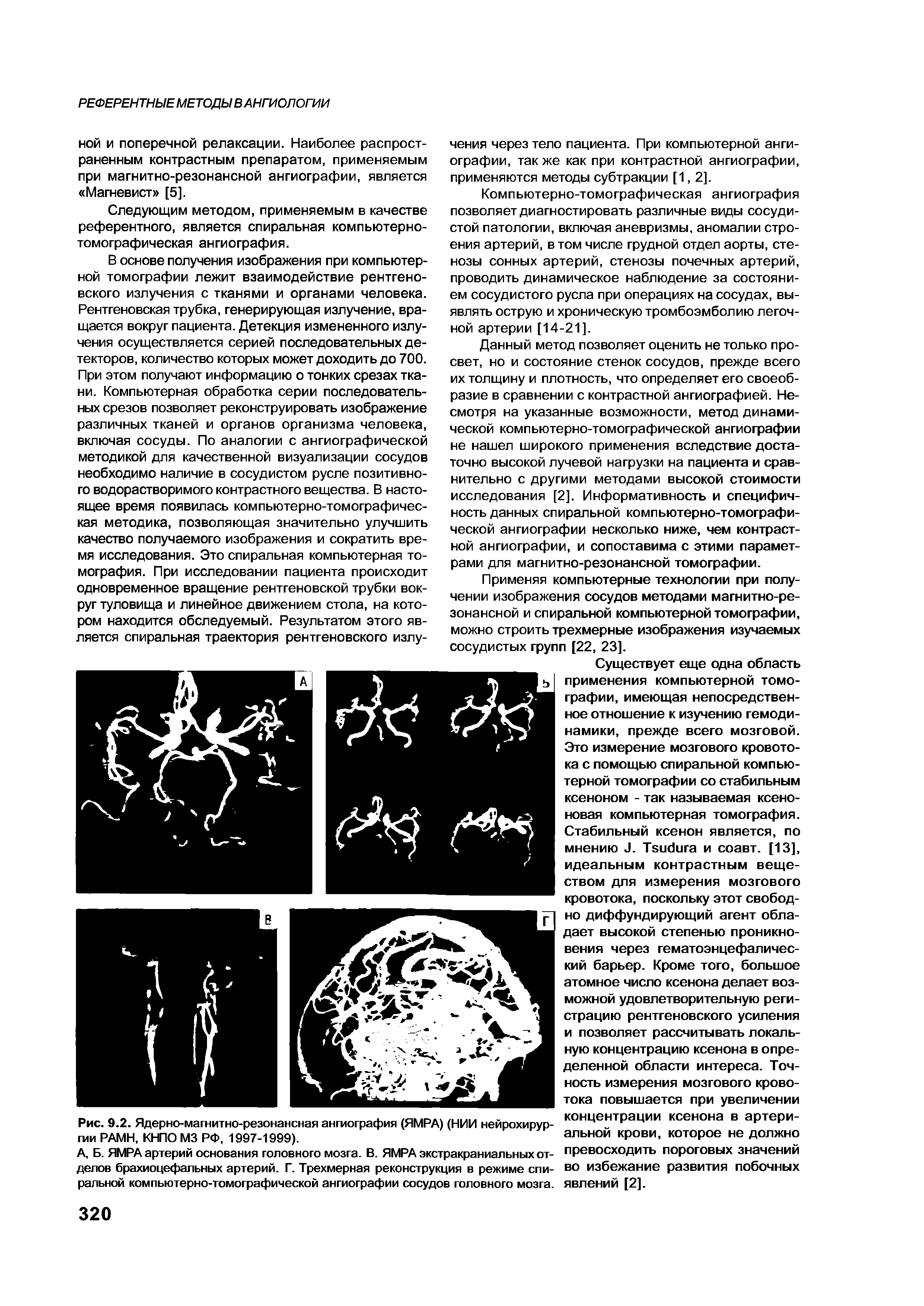 Рис. 9.2. Ядерно-магнитно-резонансная ангиография (ЯМРА) (НИИ нейрохирургии РАМН, КНПО М3 РФ, 1997-1999).