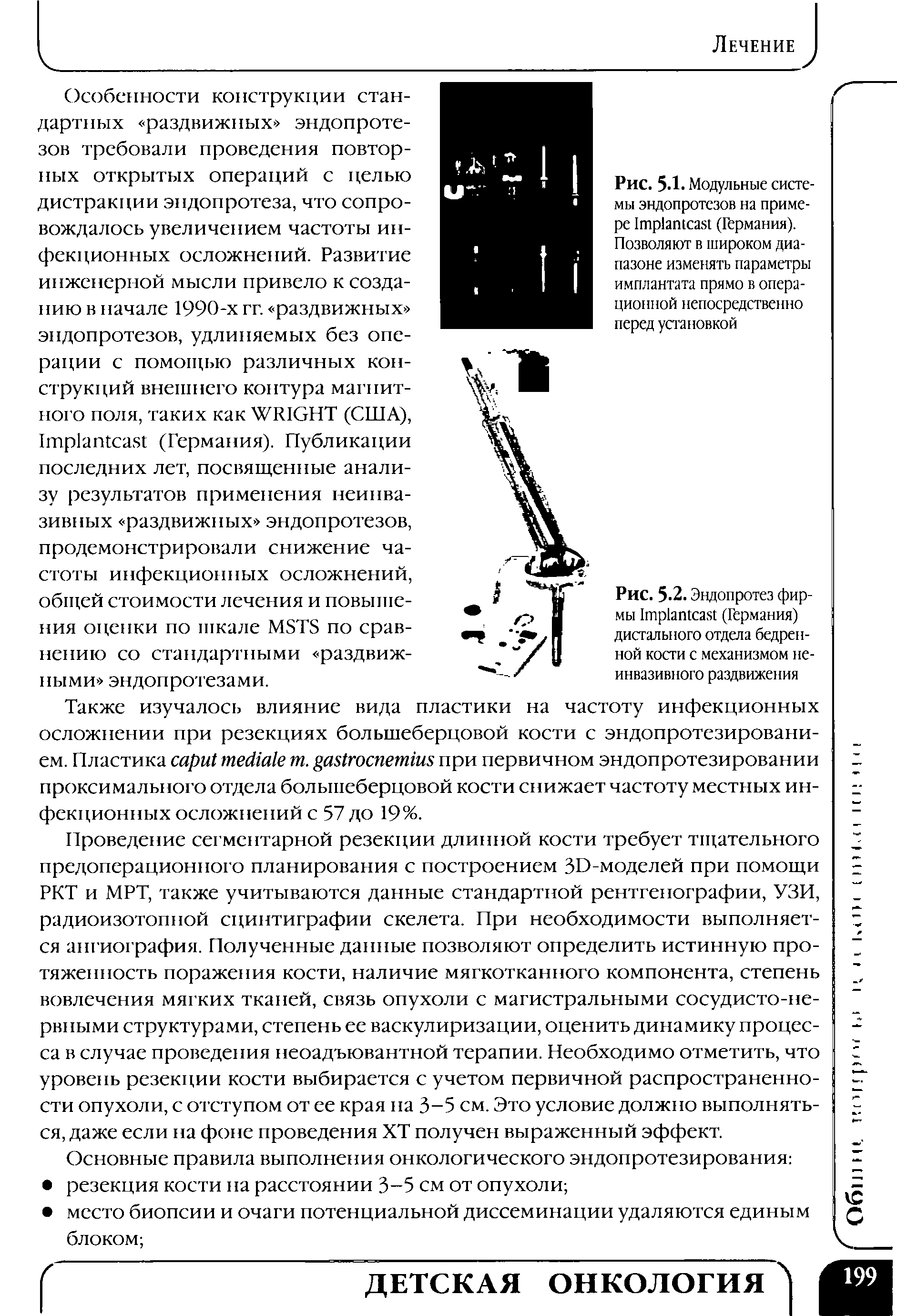 Рис. 5-2. Эндопротез фирмы 1тр1агиса81 (Германия) дистального отдела бедренной кости с механизмом неинвазивного раздвижения...