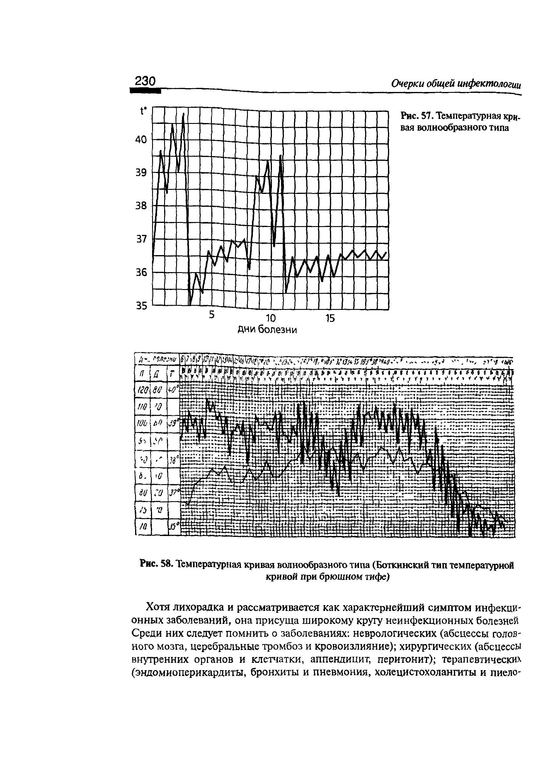 Рис. 58. Температурная кривая волнообразного типа (Боткинский тип температурной кривой при брюшном тифе)...