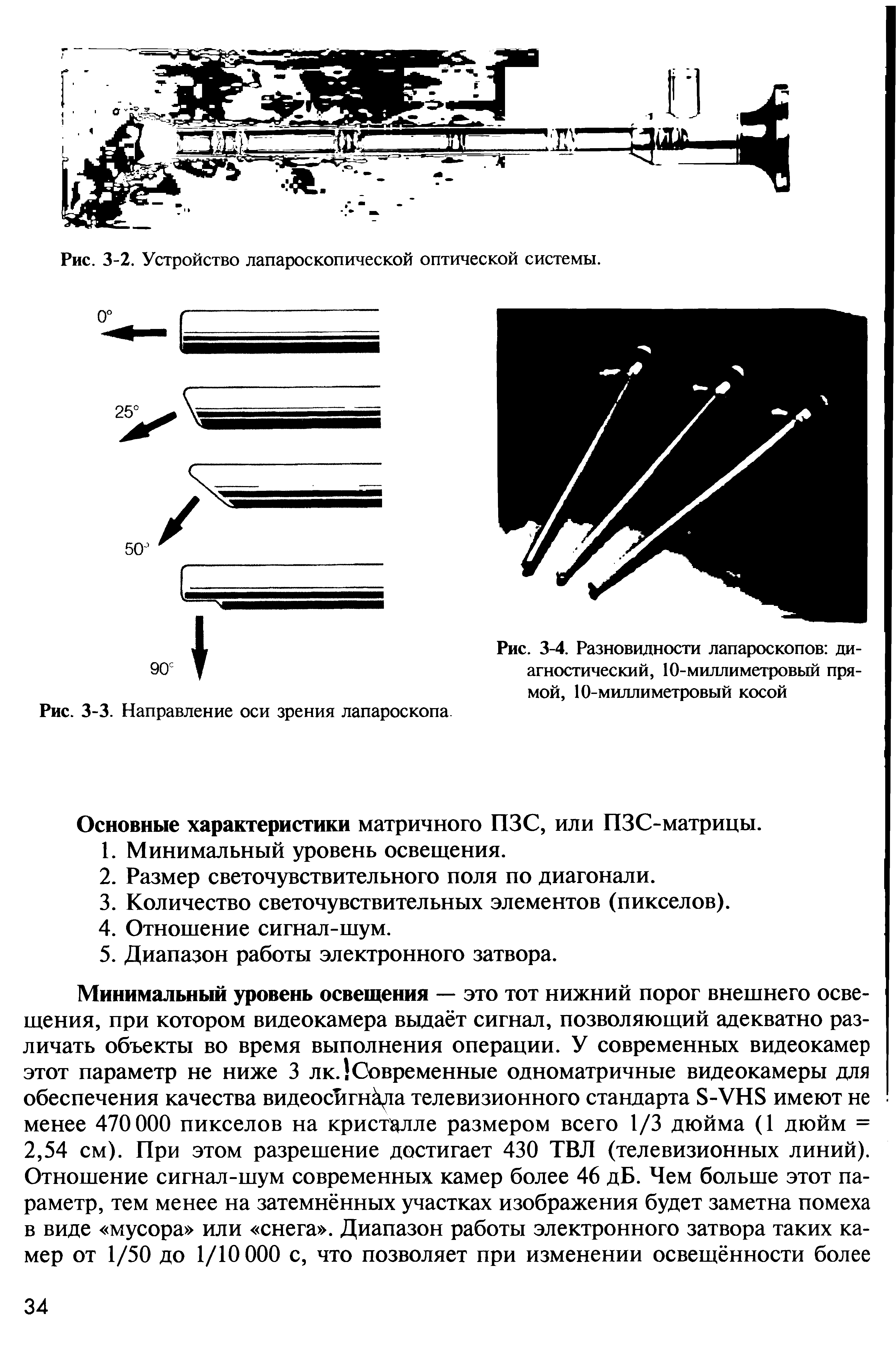 Рис. 3-4. Разновидности лапароскопов диагностический, 10-миллиметровый прямой, 10-миллиметровый косой...