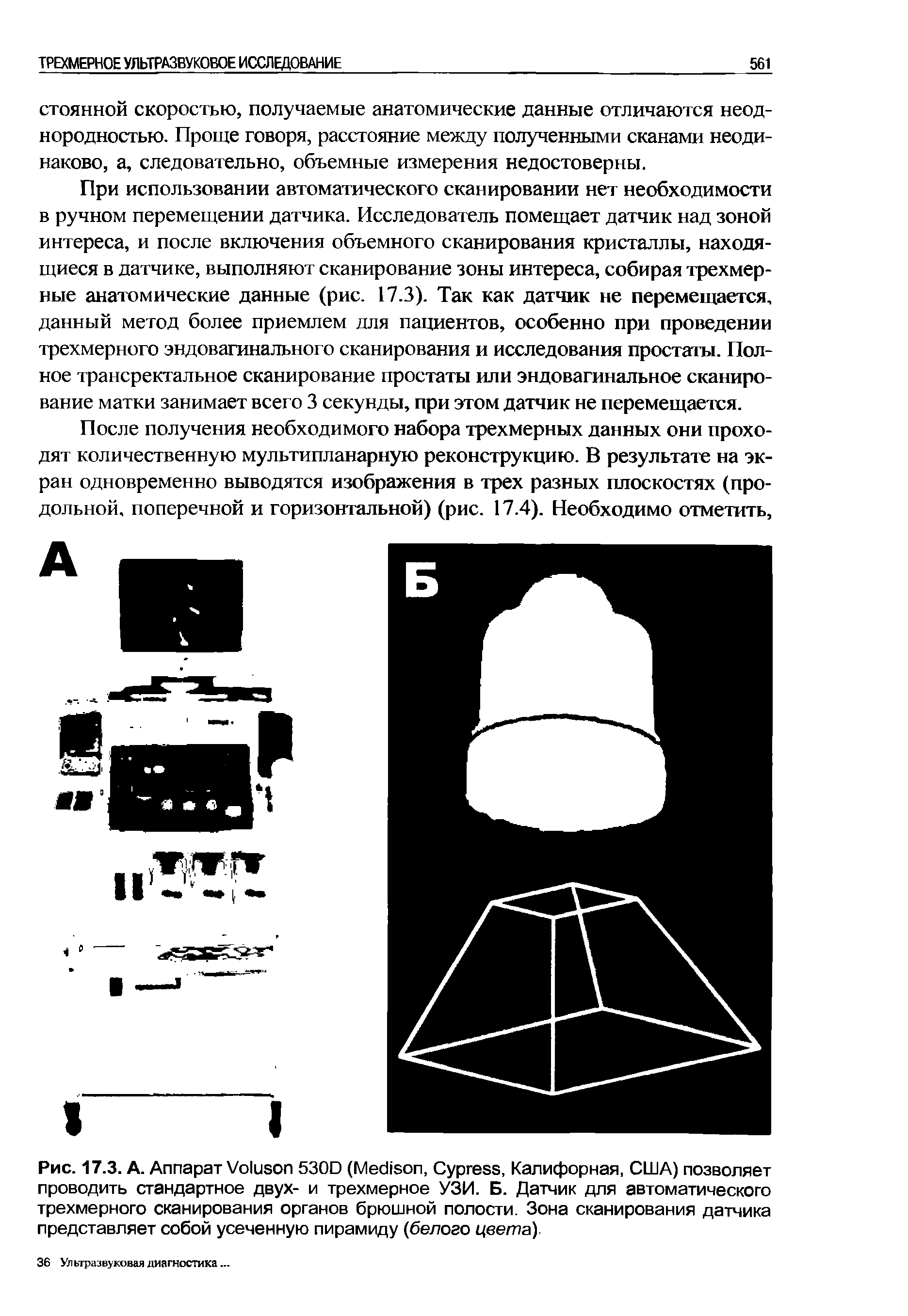 Рис. 17.3. А. Аппарат V 530D (M , C , Калифорная, США) позволяет проводить стандартное двух- и трехмерное УЗИ. Б. Датчик для автоматического трехмерного сканирования органов брюшной полости. Зона сканирования датчика представляет собой усеченную пирамиду (белого цвета).