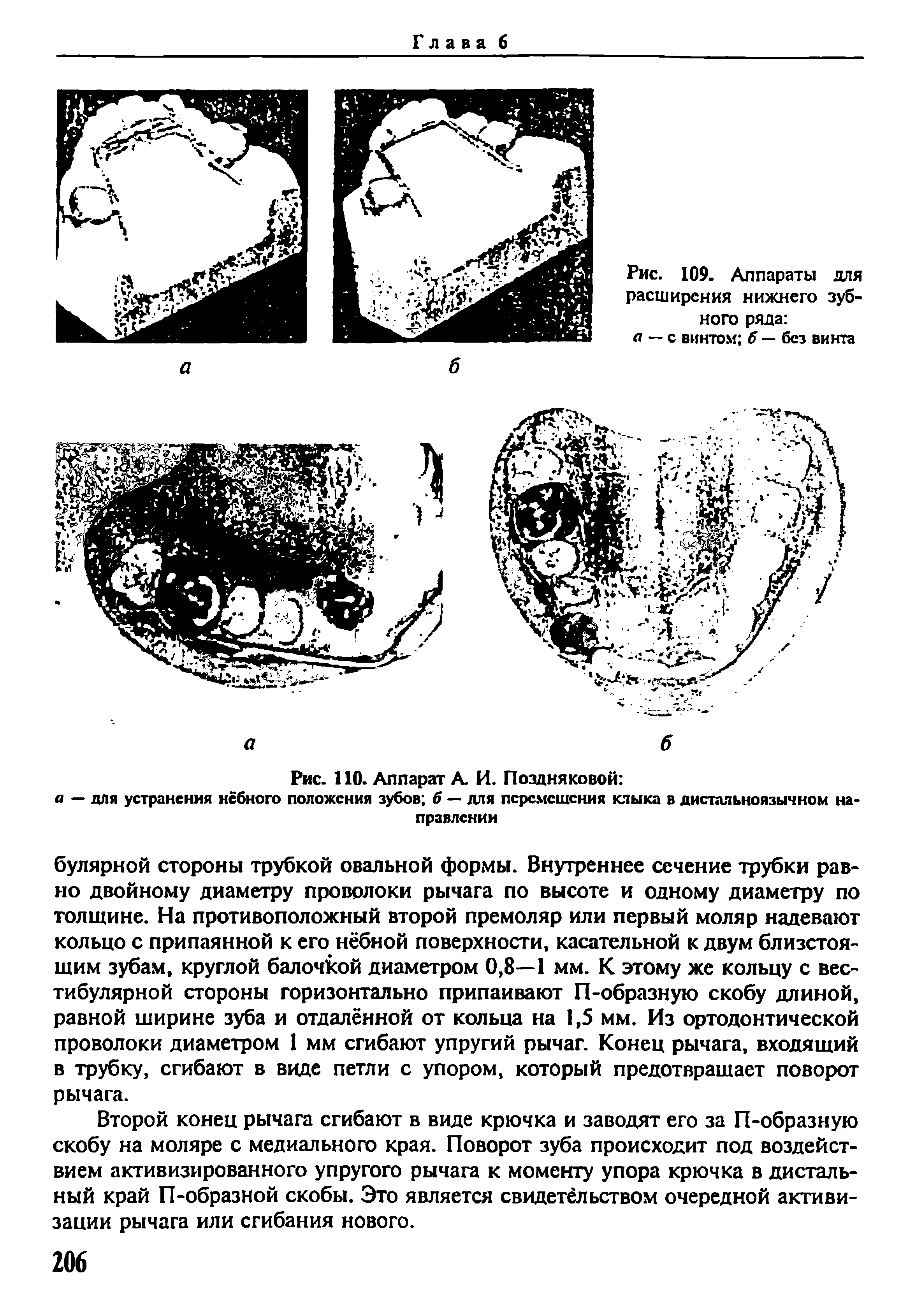 Рис. 110. Аппарат А. И. Поздняковой а — для устранения нёбного положения зубов б — для перемещения клыка в дистальноязычном направлении...