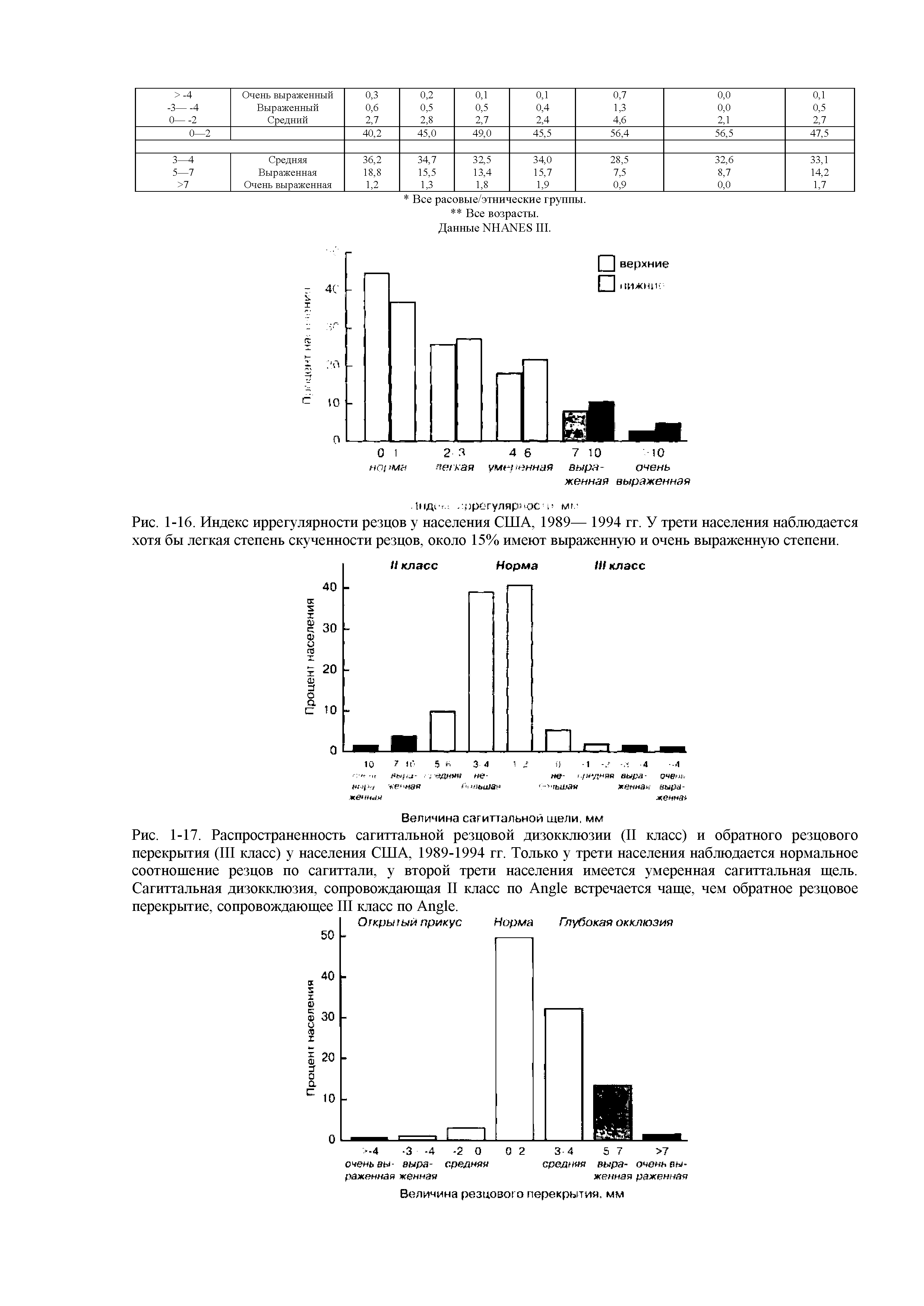 Рис. 1-16. Индекс иррегулярности резцов у населения США, 1989— 1994 гг. У трети населения наблюдается хотя бы легкая степень скученности резцов, около 15% имеют выраженную и очень выраженную степени.