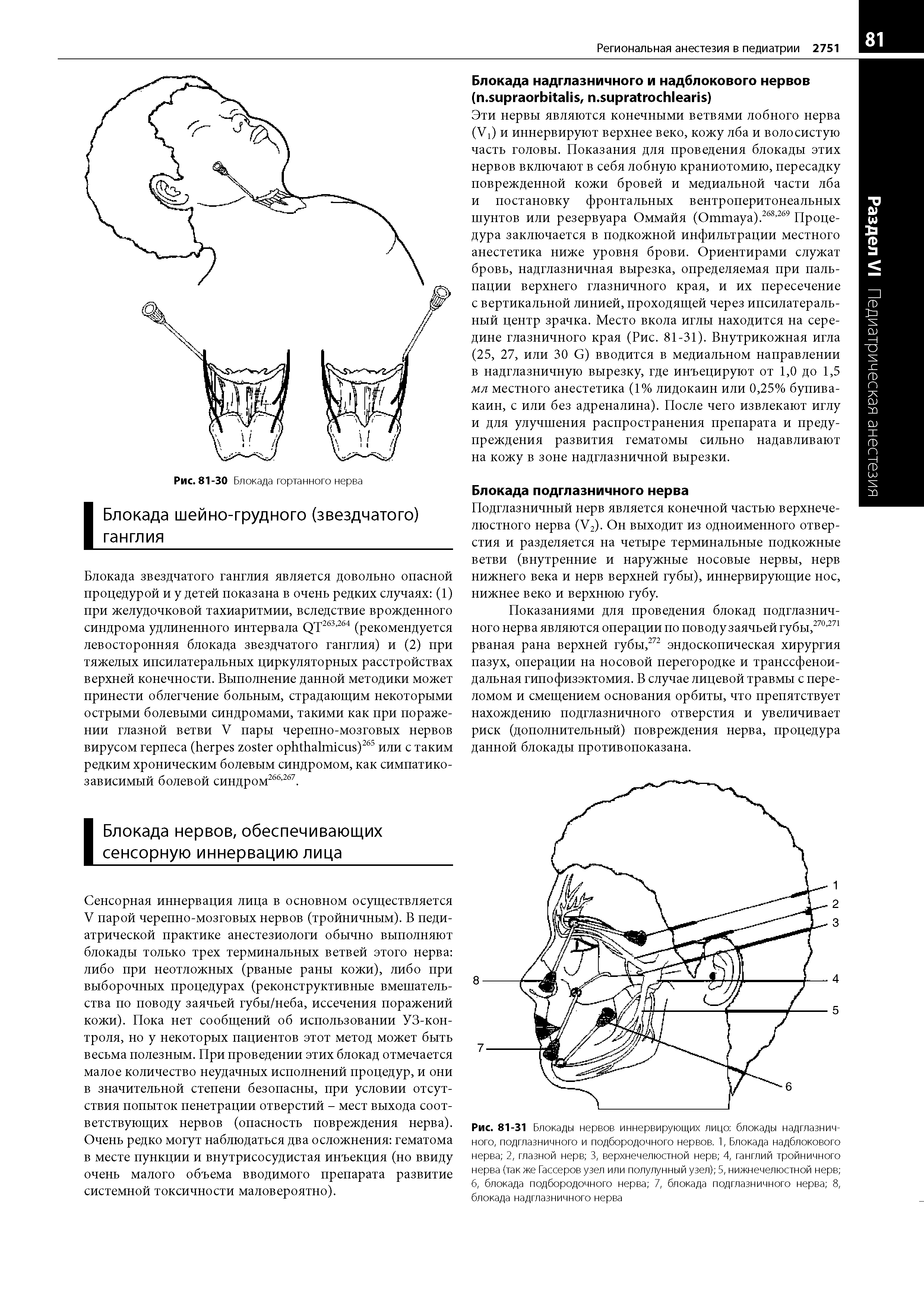 Рис. 81-31 Блокады нервов иннервирующих лицо блокады надглазничного, подглазничного и подбородочного нервов. 1, Блокада надблокового нерва 2, глазной нерв 3, верхнечелюстной нерв 4, ганглий тройничного нерва (так же Гассеров узел или полулунный узел) 5, нижнечелюстной нерв 6, блокада подбородочного нерва 7, блокада подглазничного нерва 8, блокада надглазничного нерва...