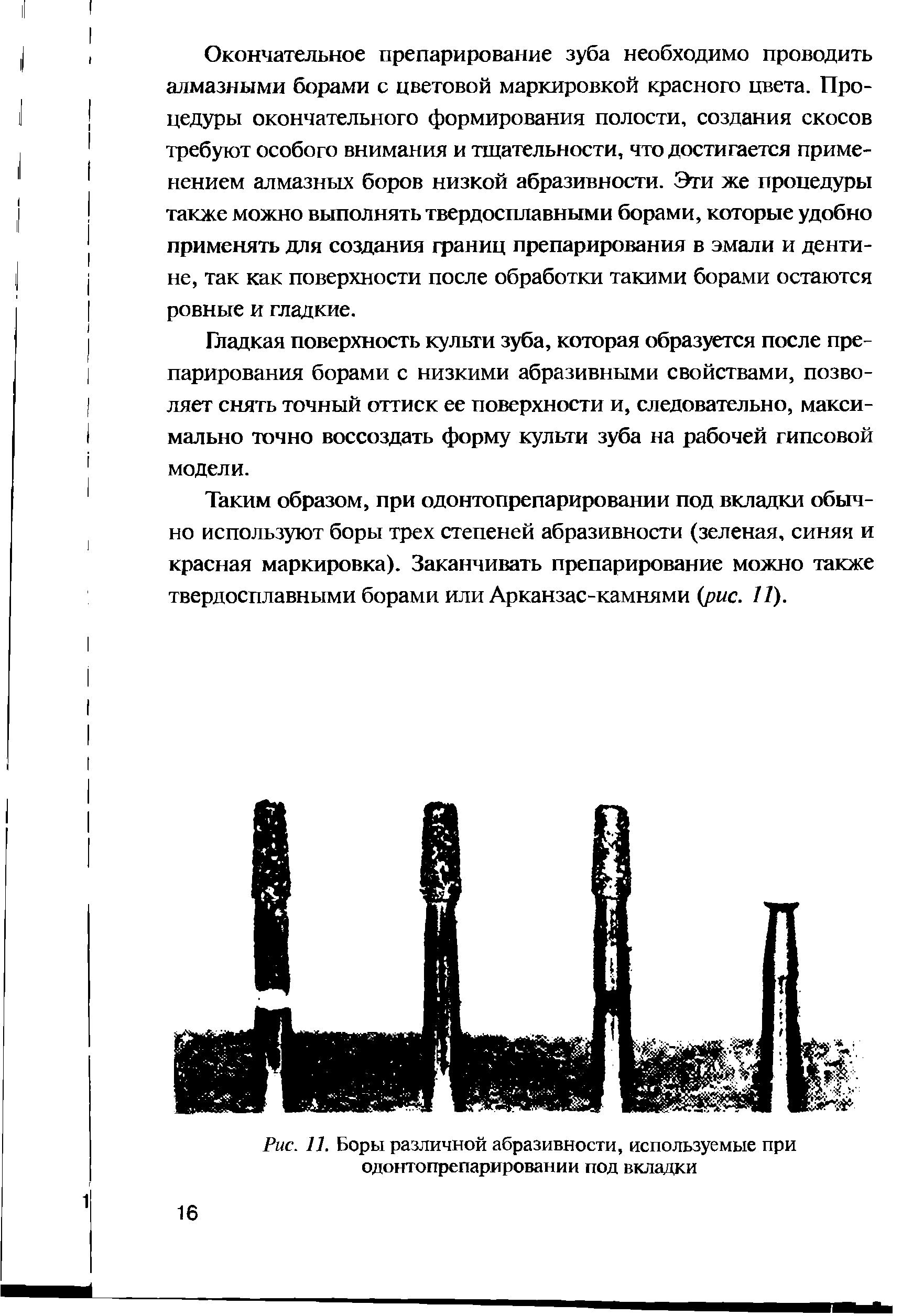 Рис. 11. Боры различной абразивности, используемые при одонтопрепарировании под вкладки...