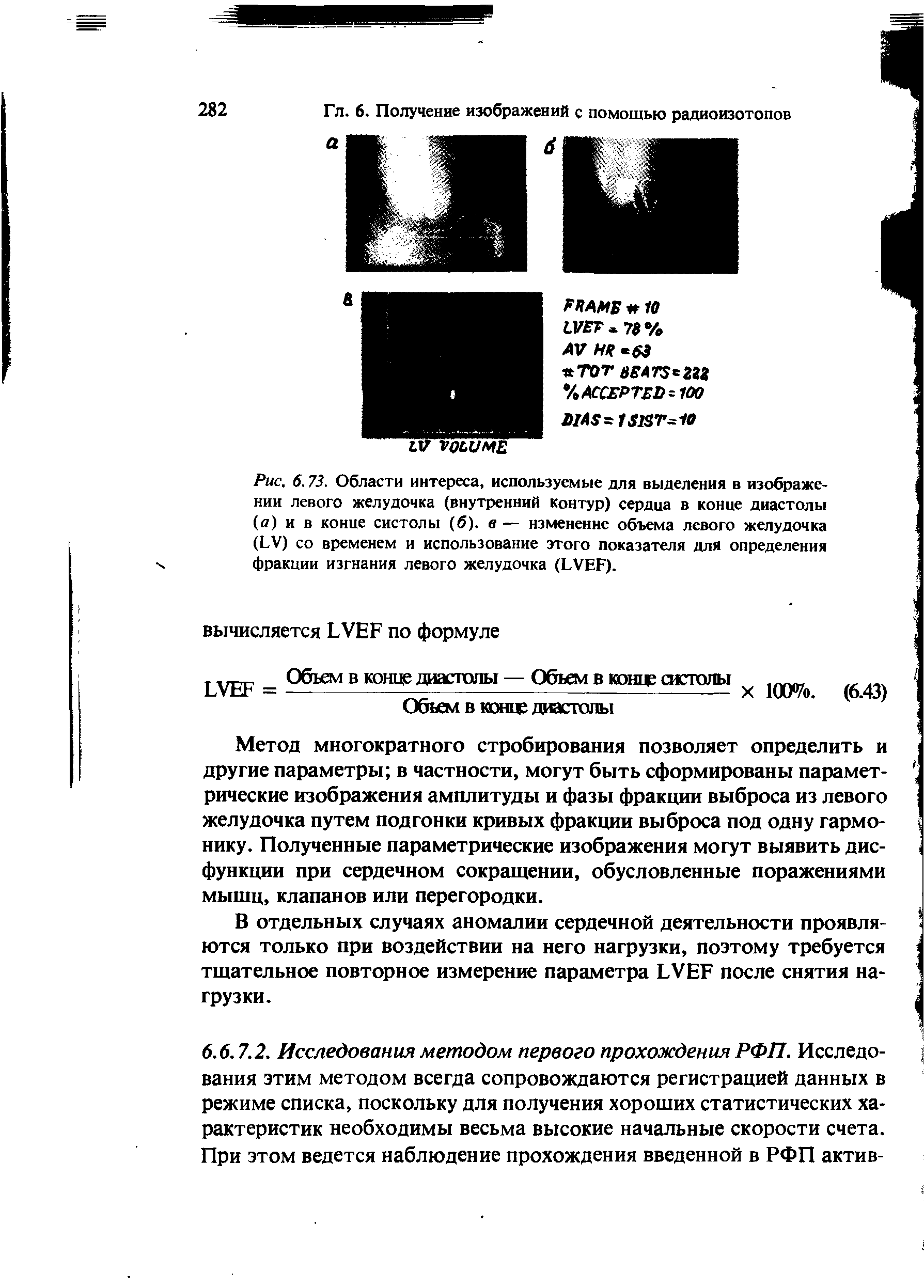 Рис. 6.73. Области интереса, используемые для выделения в изображении левого желудочка (внутренний контур) сердца в конце диастолы (а) и в конце систолы (б), в — изменение объема левого желудочка (ЬУ) со временем и использование этого показателя для определения х фракции изгнания левого желудочка (ЬУЕР).