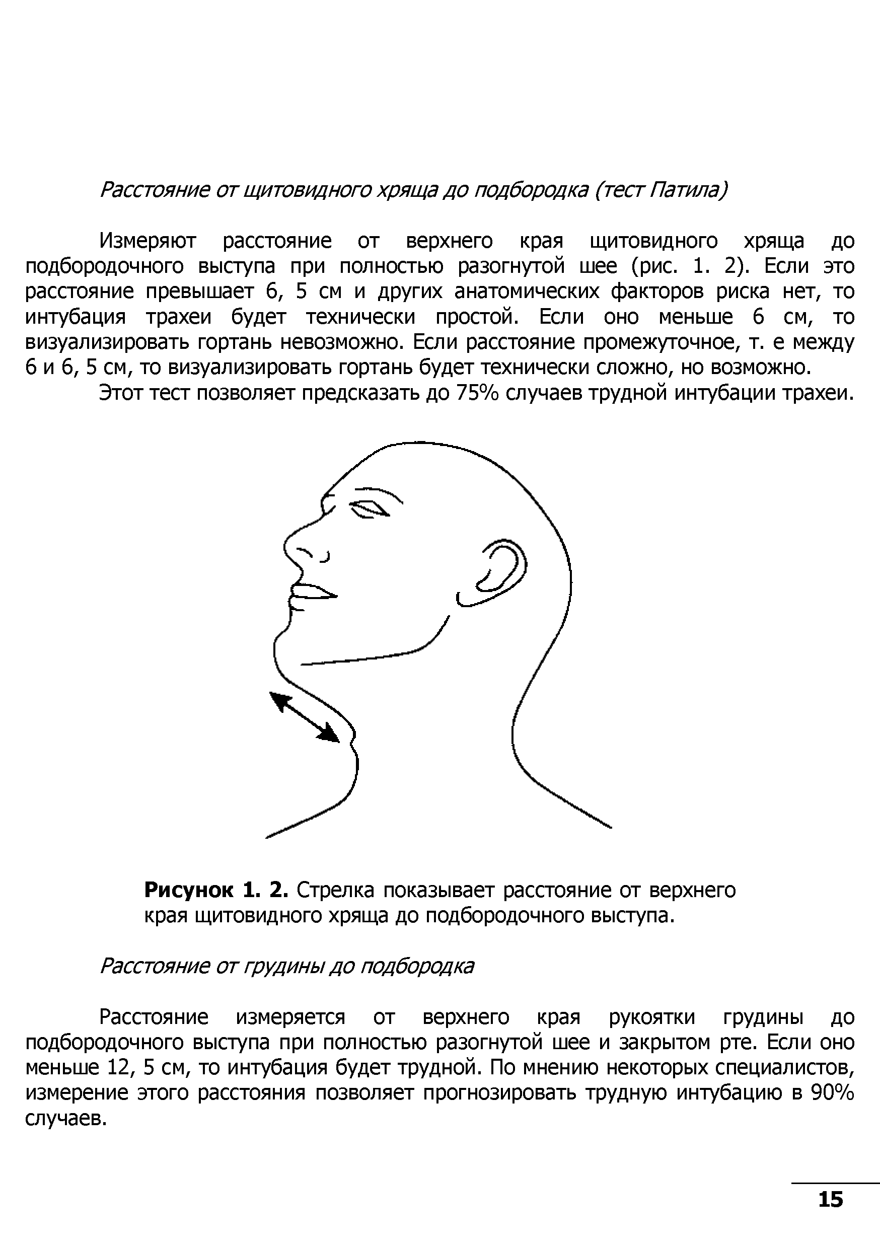 Рисунок 1. 2. Стрелка показывает расстояние от верхнего края щитовидного хряща до подбородочного выступа.