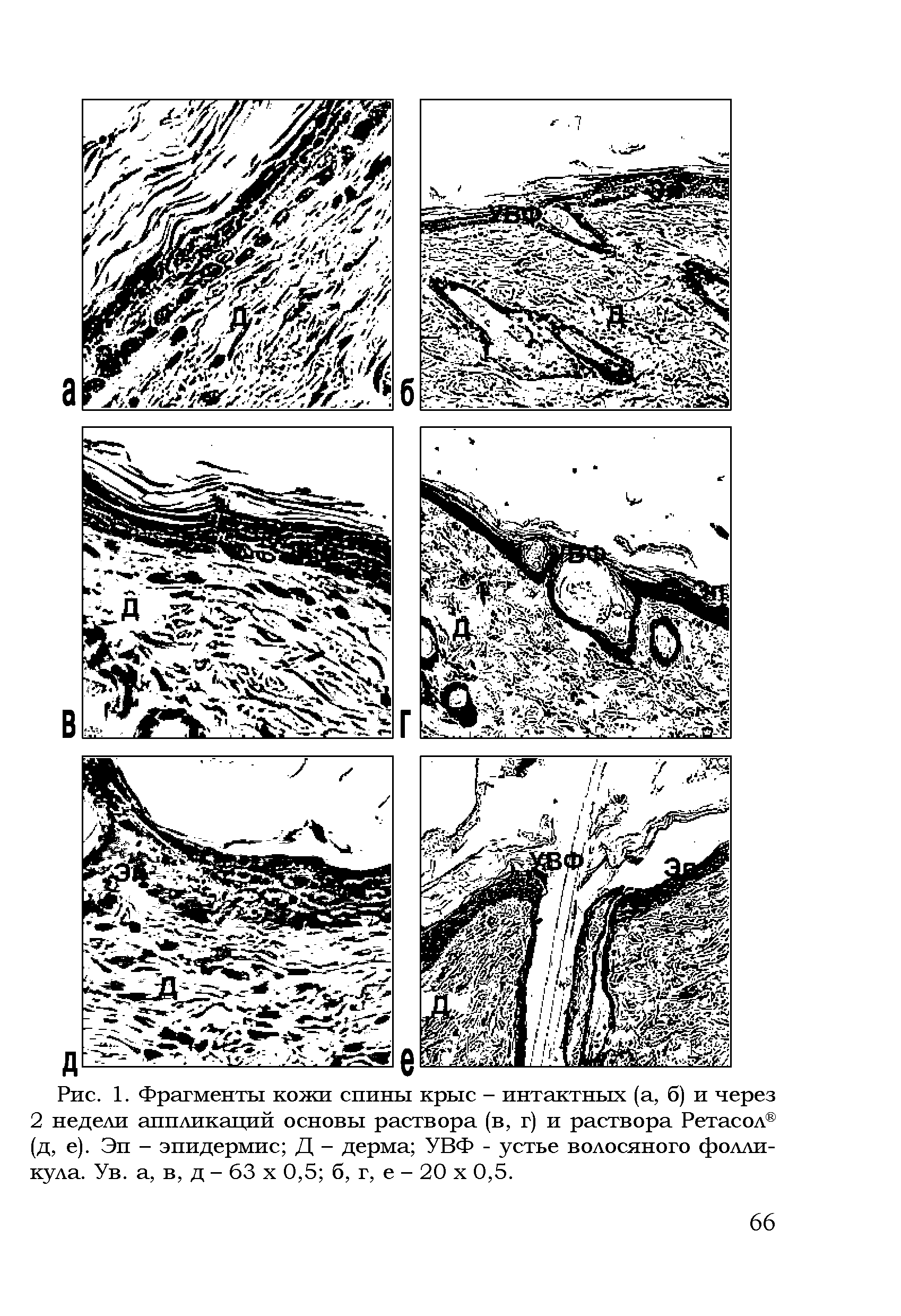 Рис. 1. Фрагменты кожи спины крыс - интактных (а, б) и через 2 недели аппликаций основы раствора (в, г) и раствора Ретасол (д, е). Эи - эпидермис Д - дерма УВФ - устье волосяного фолликула. Ув. а, в, д - 63 х 0,5 б, г, е - 20 х 0,5.