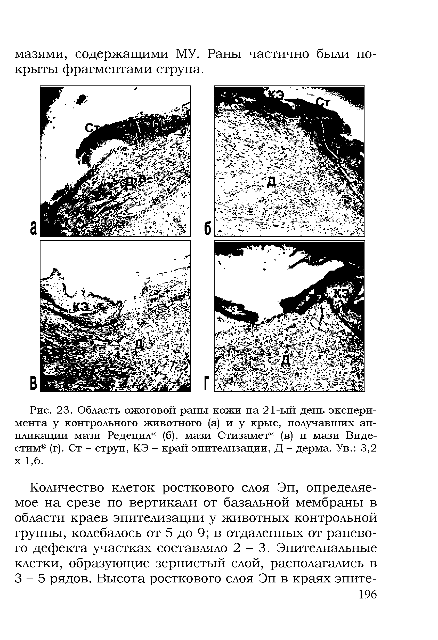 Рис. 23. Область ожоговой раны кожи на 21-ый день эксперимента у контрольного животного (а) и у крыс, получавших аппликации мази Редецил (б), мази Стизамет (в) и мази Виде-стим (г). Ст - струп, КЭ - край эпителизации, Д - дерма. Ув. 3,2 х 1,6.