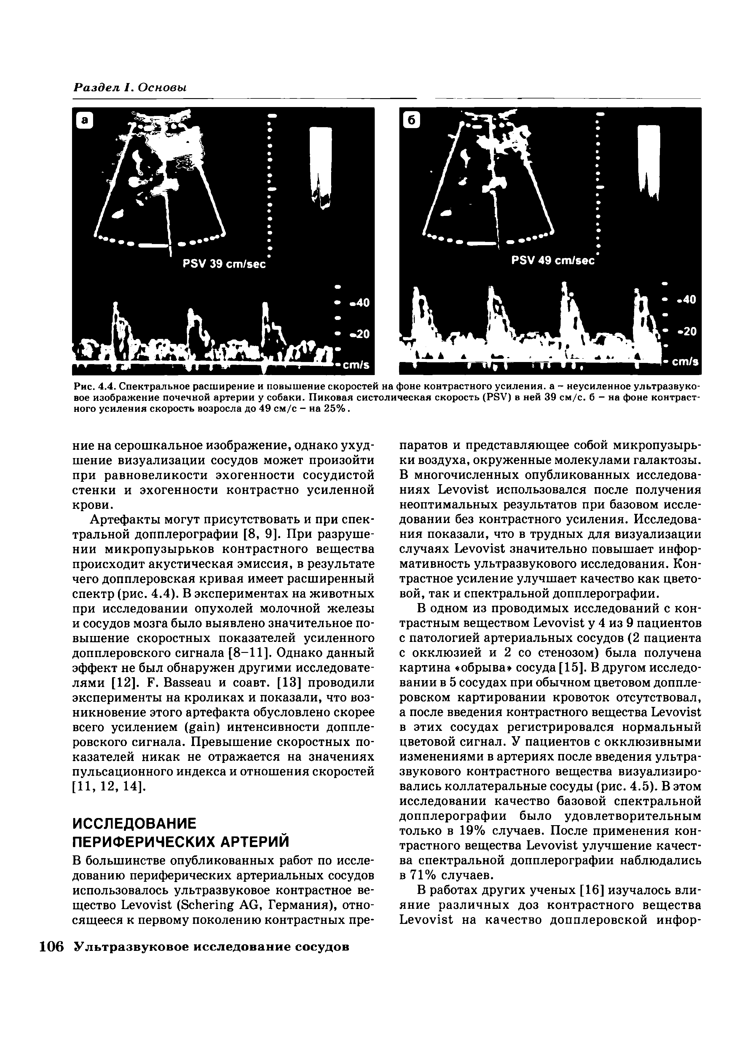 Рис. 4.4. Спектральное расширение и повышение скоростей на фоне контрастного усиления, а - неусиленное ультразвуковое изображение почечной артерии у собаки. Пиковая систолическая скорость (РЭУ) в ней 39 см/с. б - на фоне контрастного усиления скорость возросла до 49 см/с - на 25%.