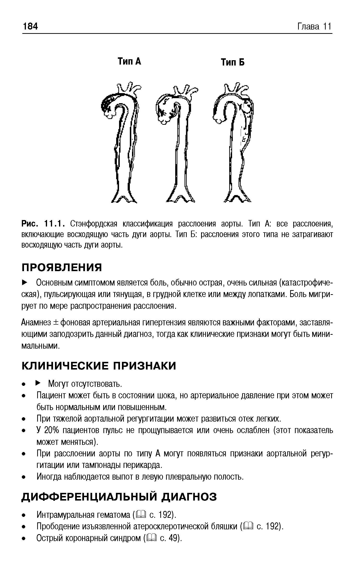 Рис. 11.1. Стэнфордская классификация расслоения аорты. Тип А все расслоения, включающие восходящую часть дуги аорты. Тип Б расслоения этого типа не затрагивают восходящую часть дуги аорты.